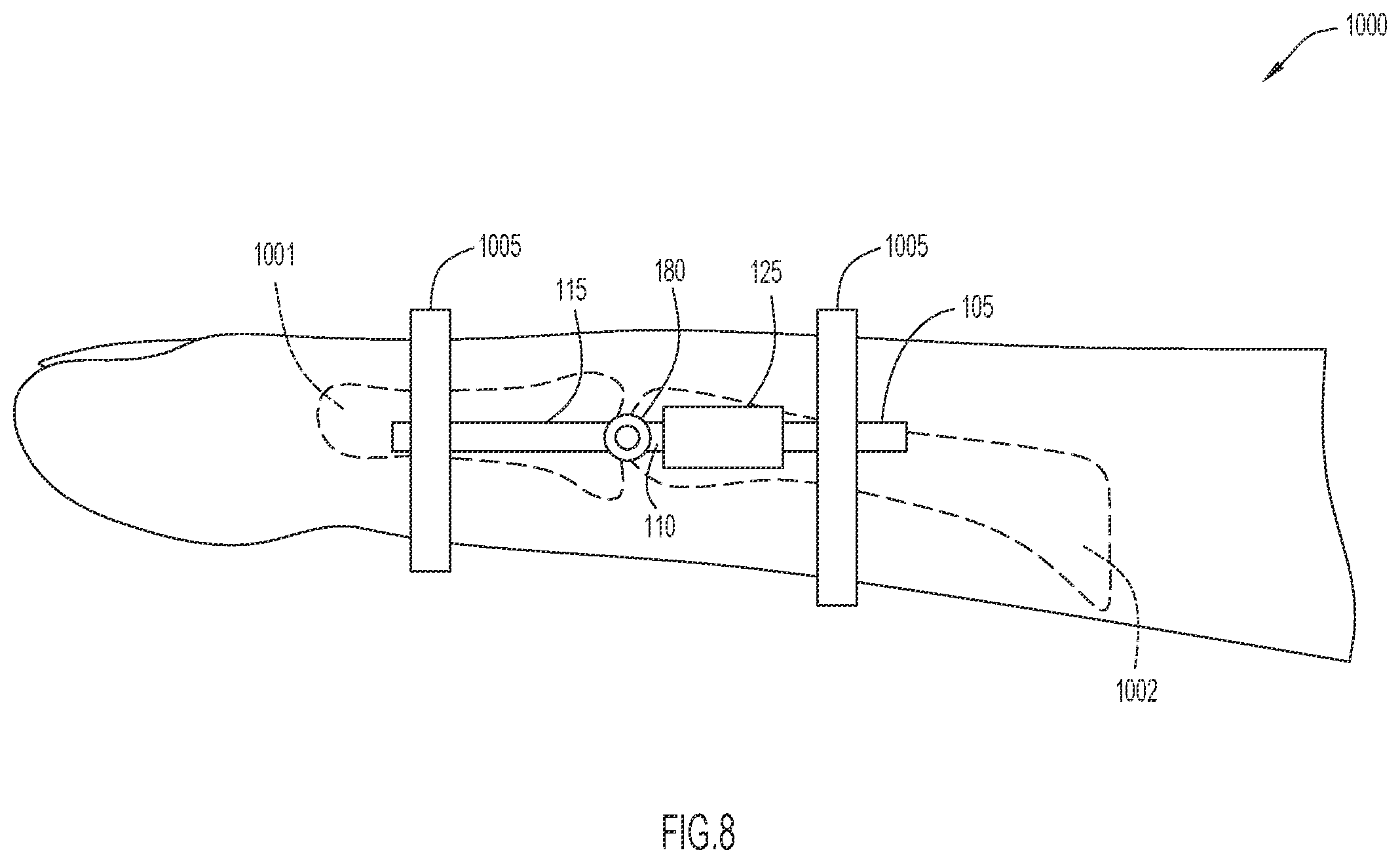 Patent US12496210 Figure 8 – Method and apparatus to maintain distance between bones of a neck for pain relief