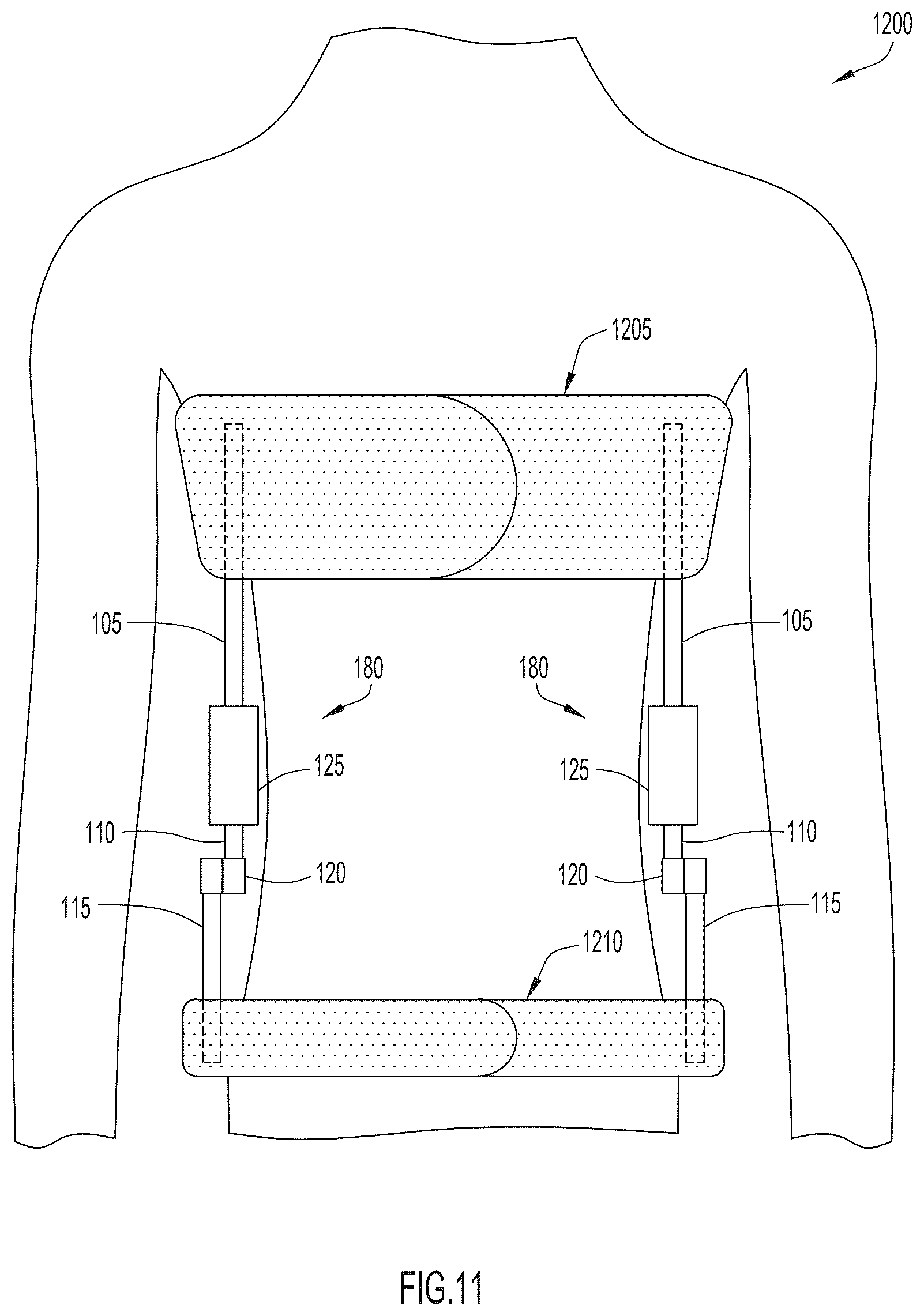 Patent US12496210 Figure 11 – Method and apparatus to maintain distance between bones of a neck for pain relief