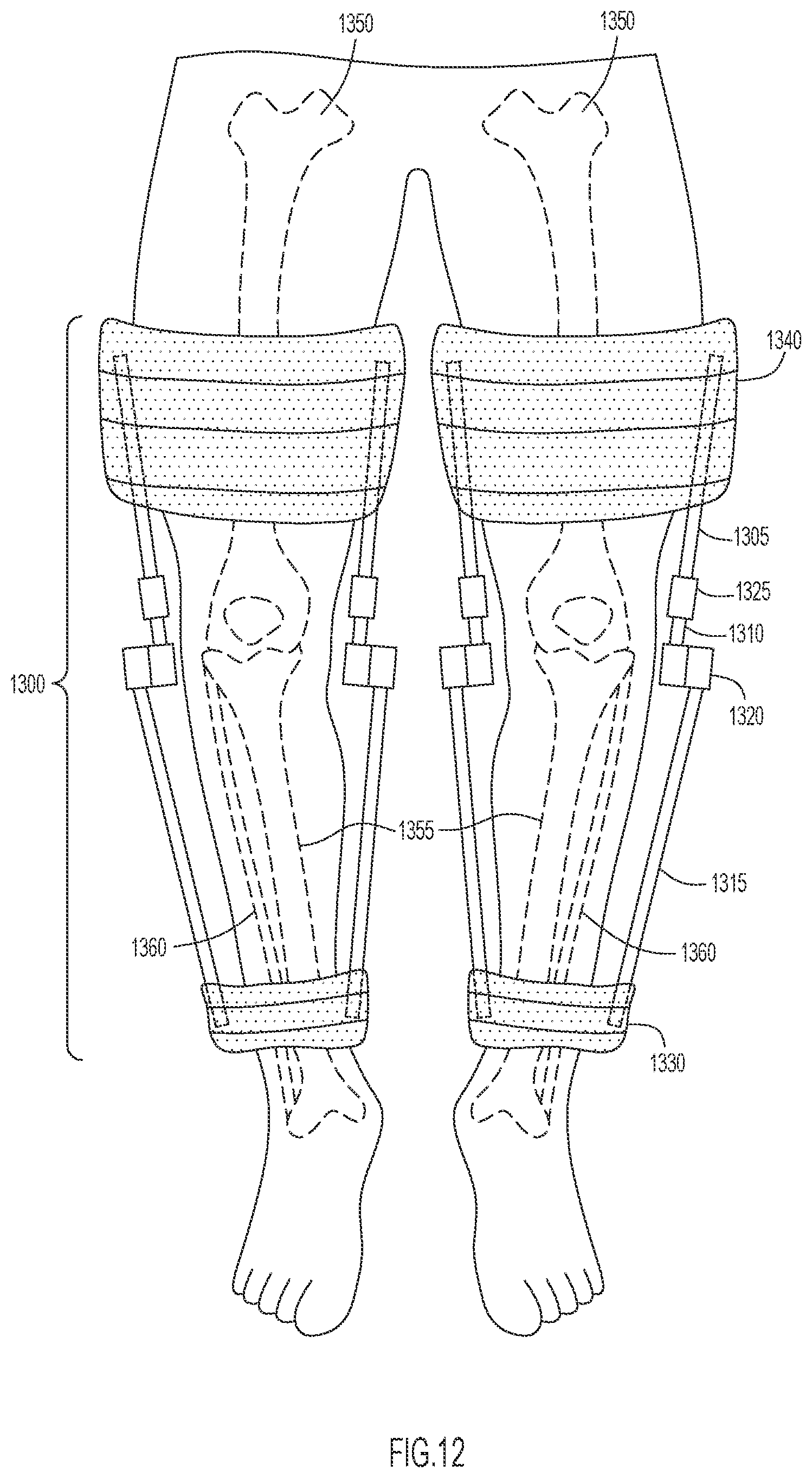 Patent US12496210 Figure 12 – Method and apparatus to maintain distance between bones of a neck for pain relief