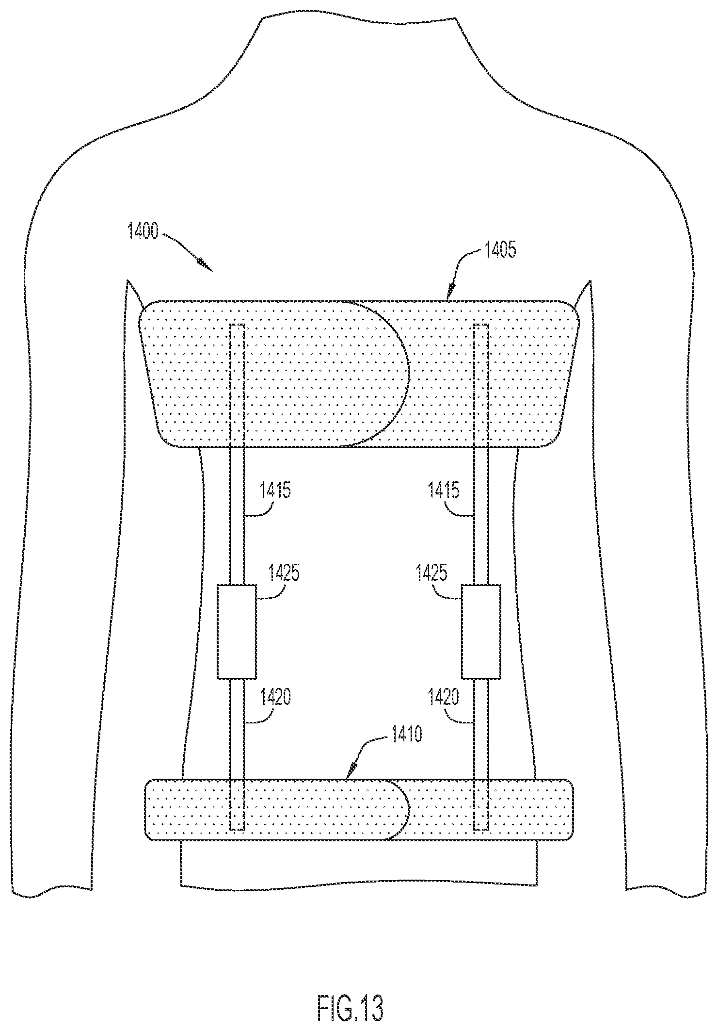 Patent US12496210 Figure 13 – Method and apparatus to maintain distance between bones of a neck for pain relief