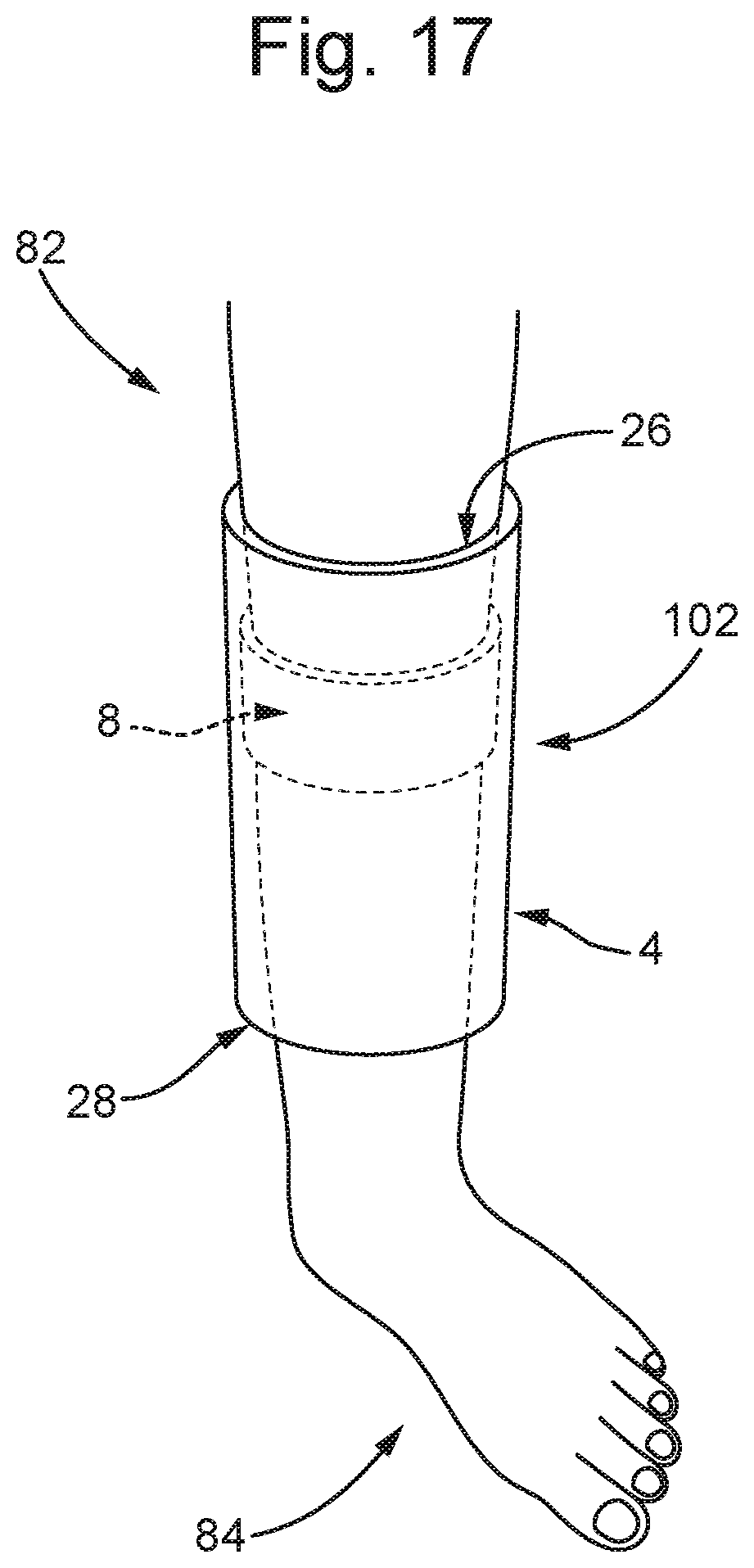 Patent US12496211 Figure 14 – Limb shielding devices