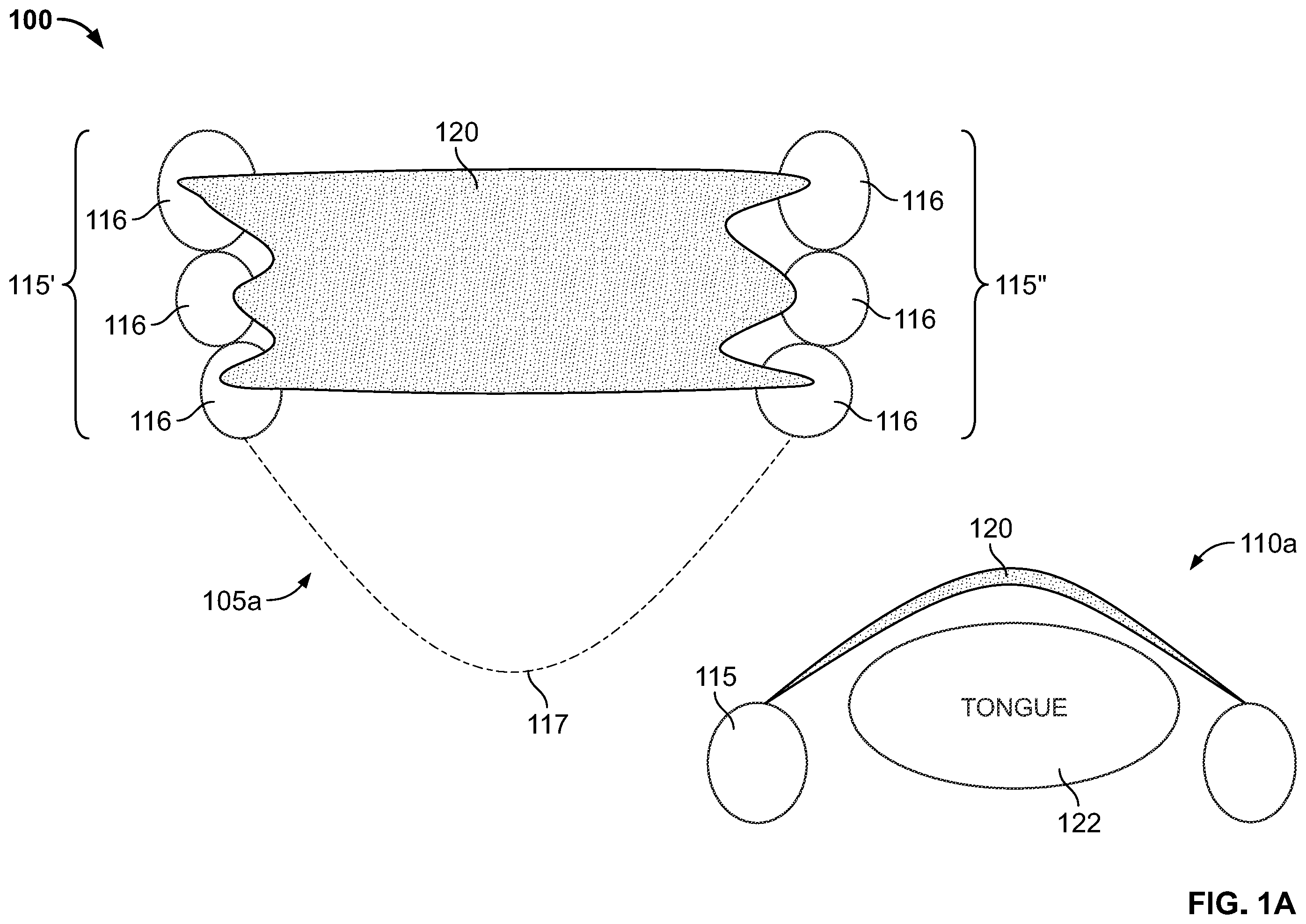 Patent US12496212 Figure 1 – Devices for treating obstructive sleep apnea