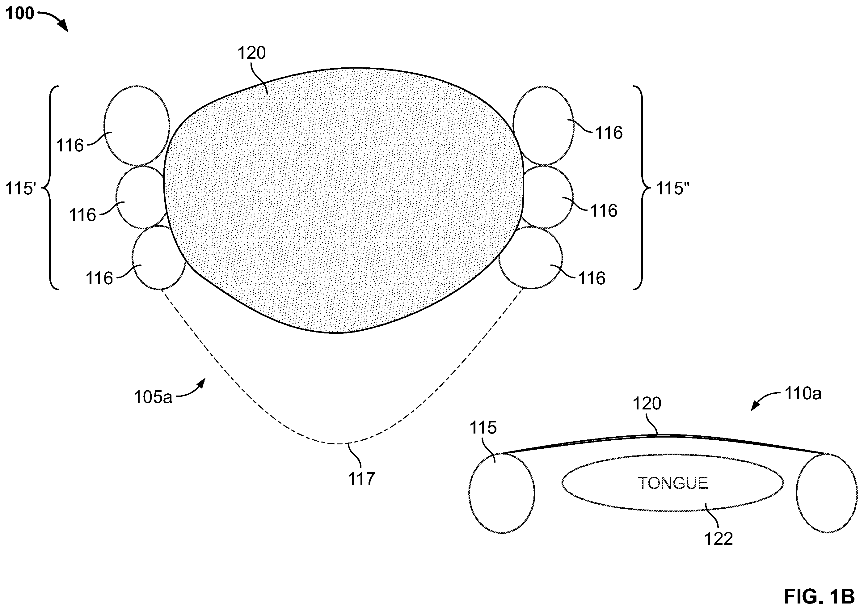 Patent US12496212 Figure 2 – Devices for treating obstructive sleep apnea