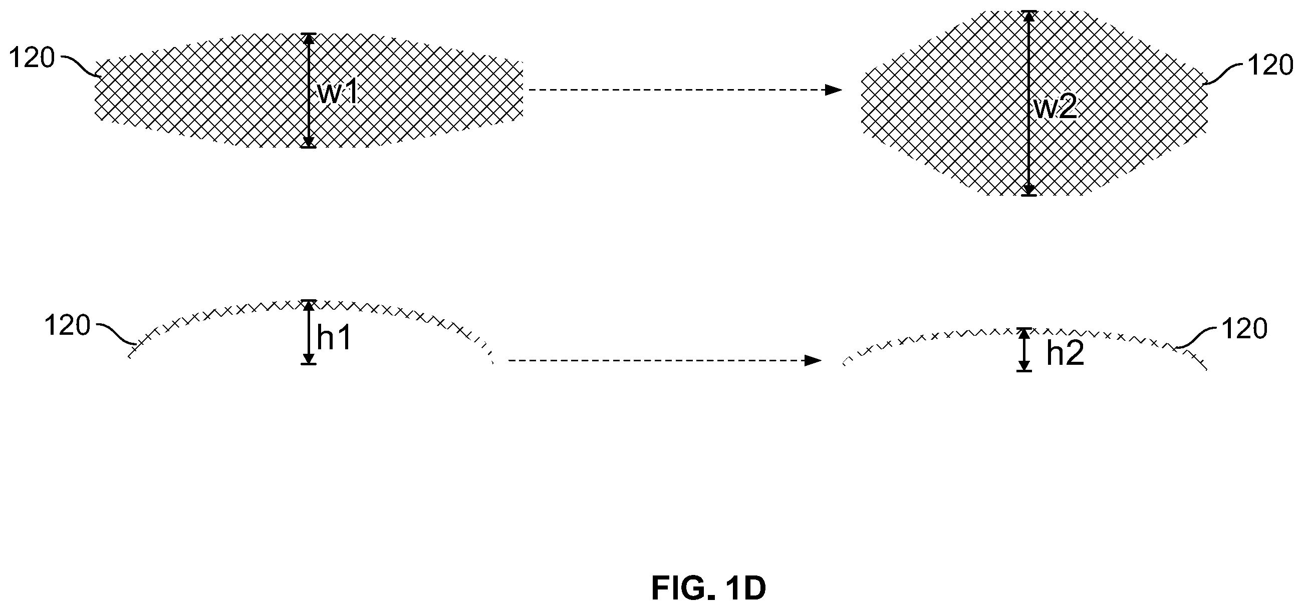 Patent US12496212 Figure 4 – Devices for treating obstructive sleep apnea
