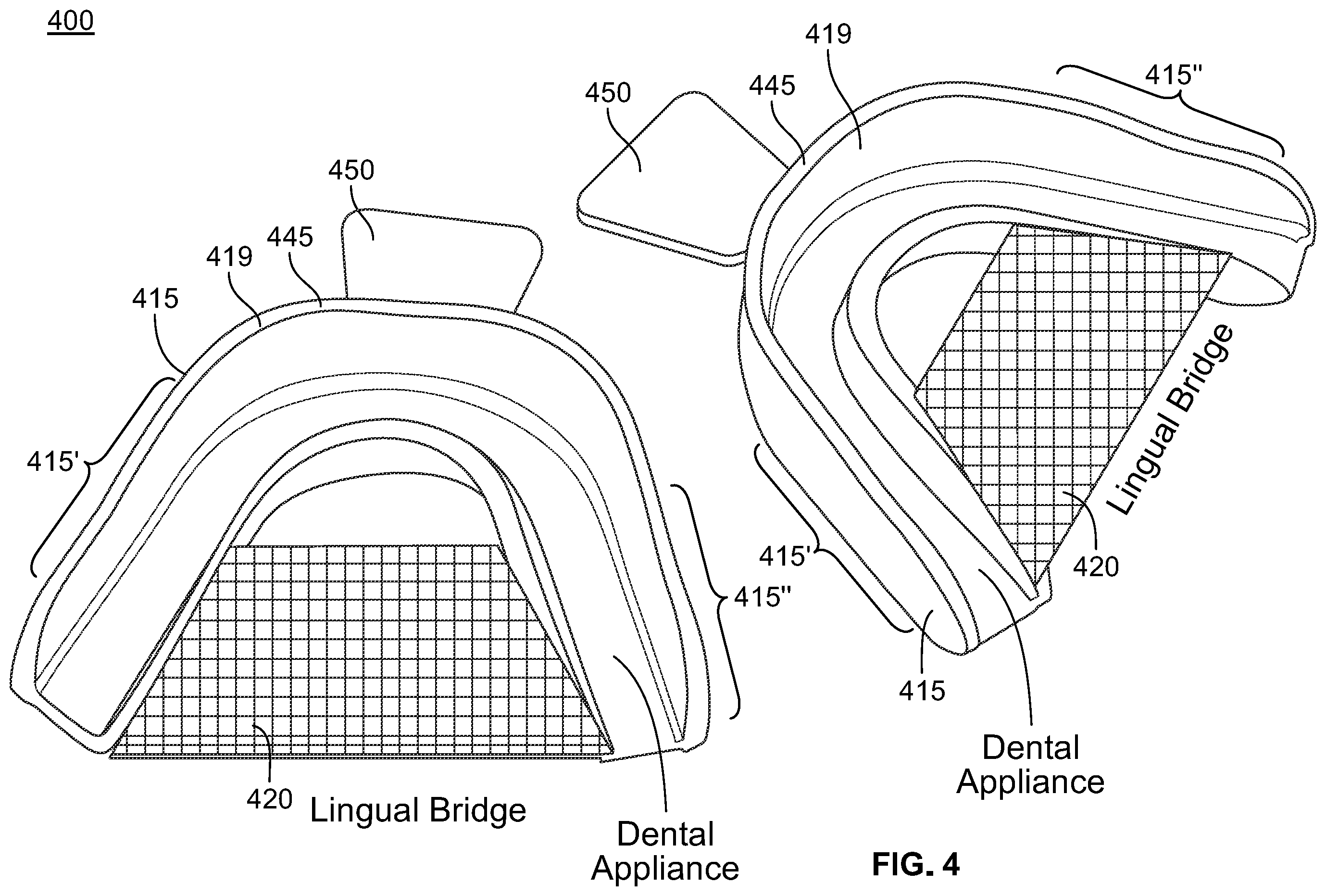 Patent US12496212 Figure 8 – Devices for treating obstructive sleep apnea