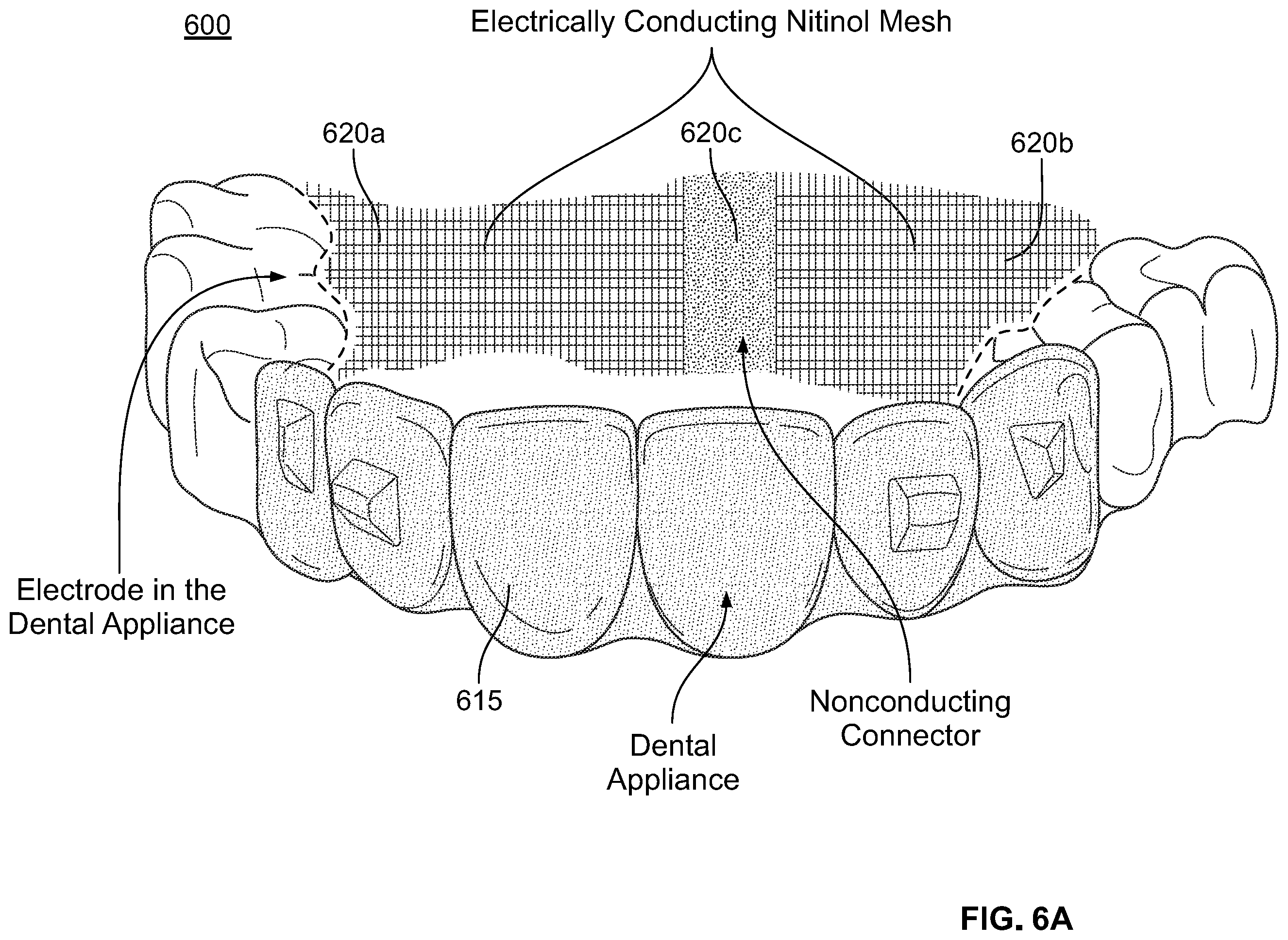 Patent US12496212 Figure 10 – Devices for treating obstructive sleep apnea