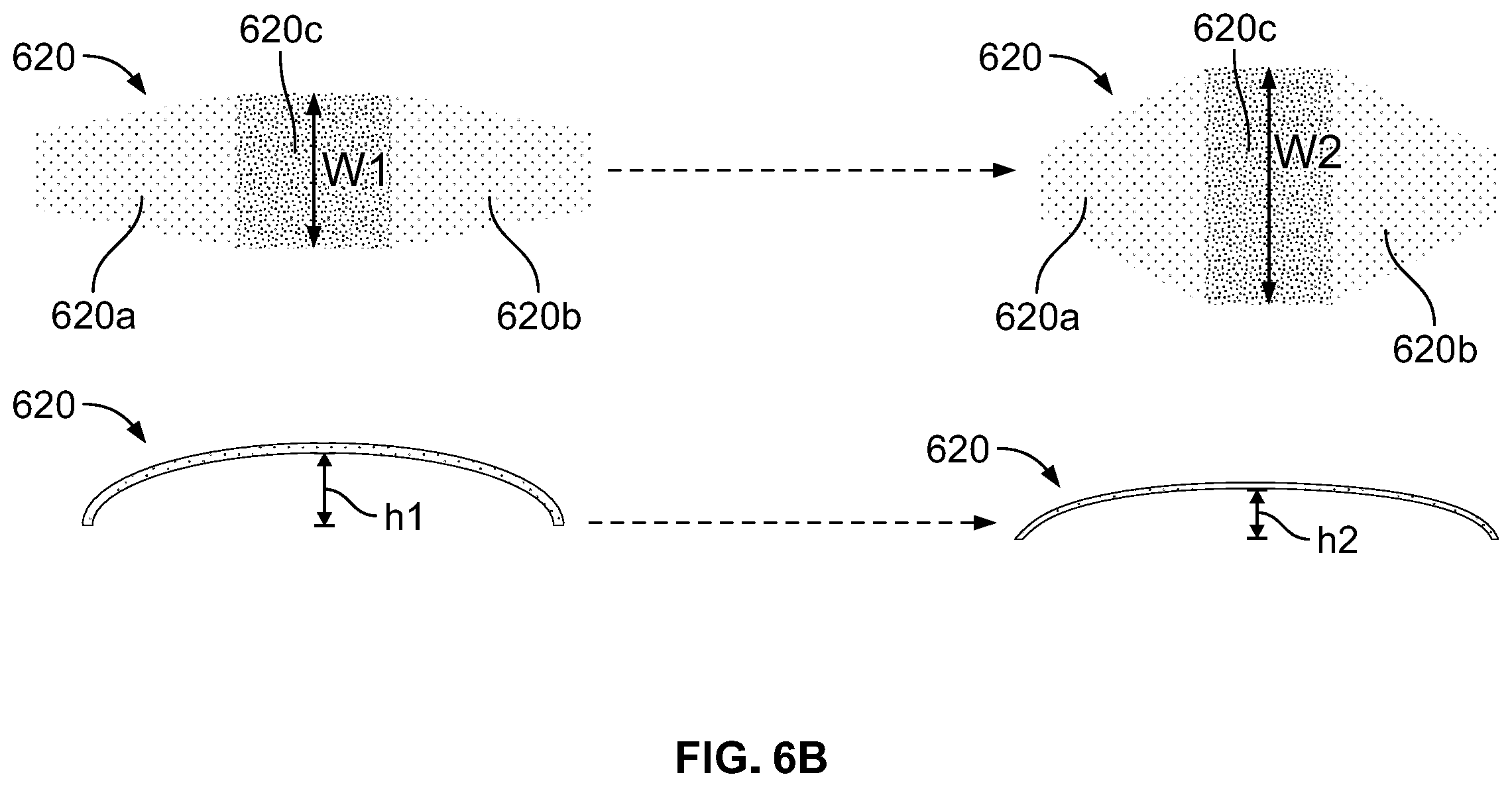 Patent US12496212 Figure 11 – Devices for treating obstructive sleep apnea