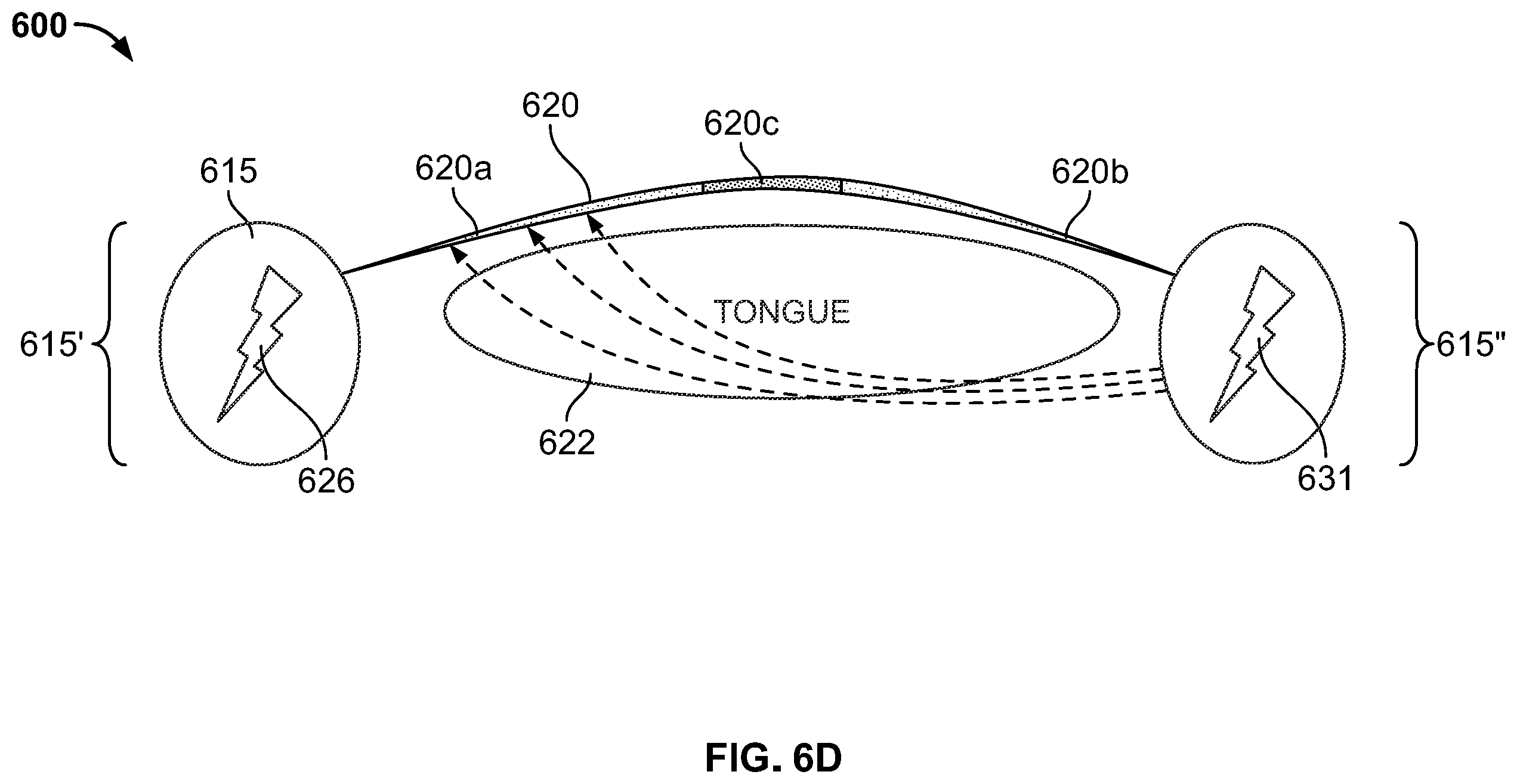 Patent US12496212 Figure 13 – Devices for treating obstructive sleep apnea