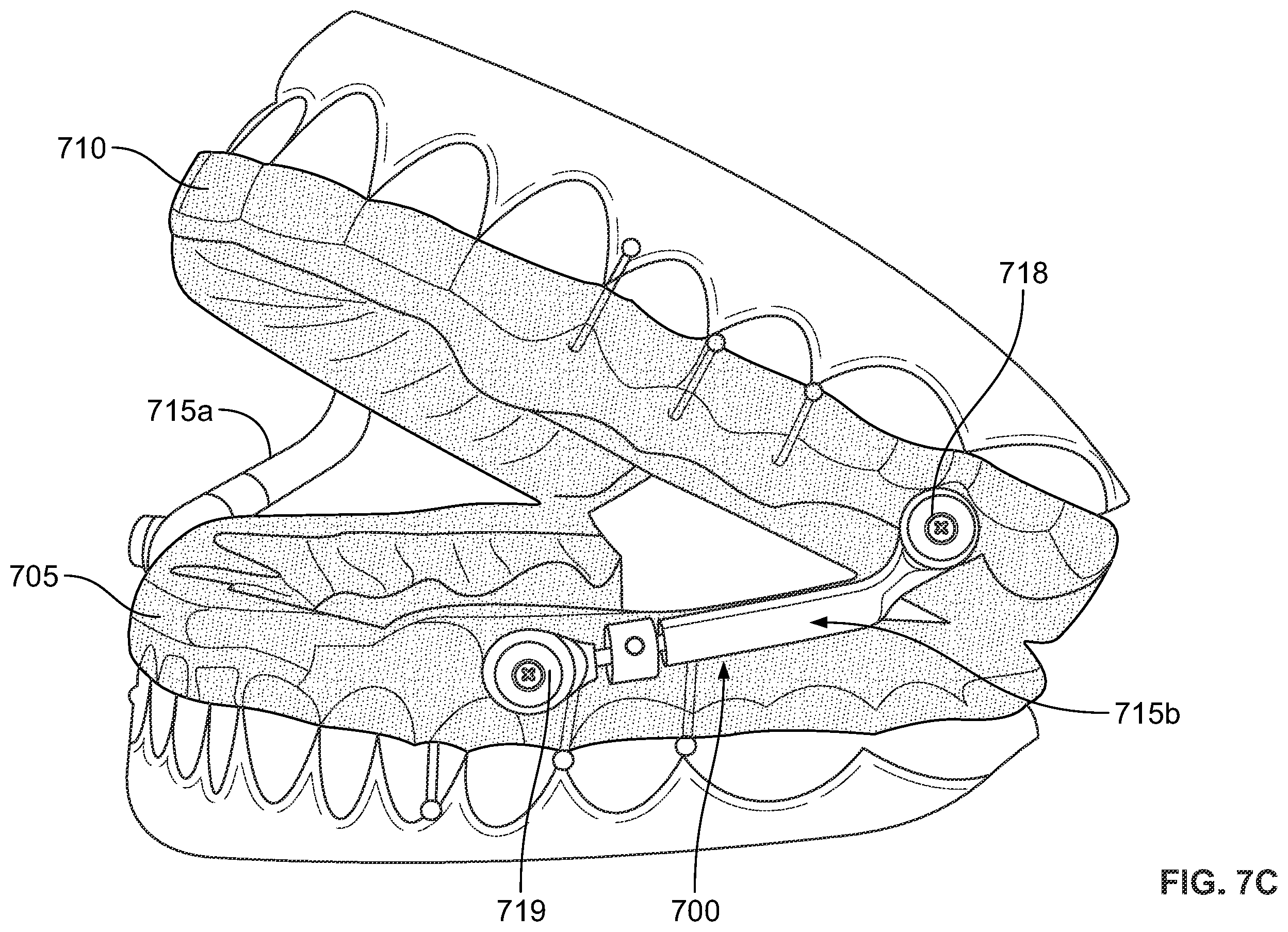 Patent US12496212 Figure 16 – Devices for treating obstructive sleep apnea