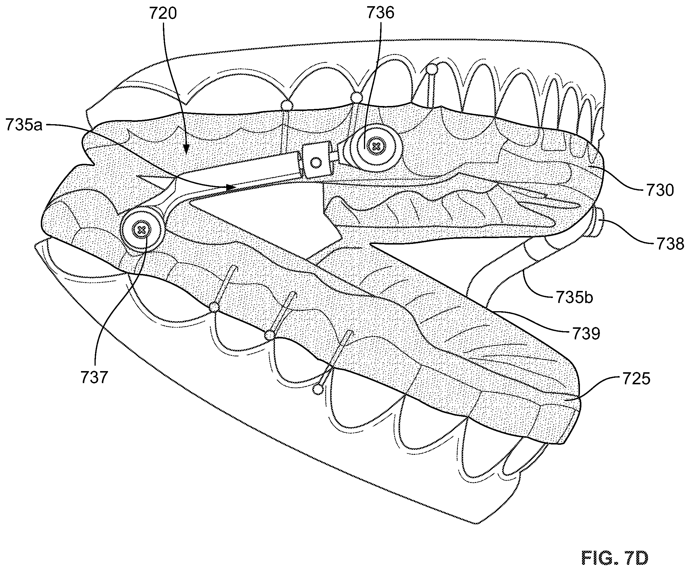 Patent US12496212 Figure 17 – Devices for treating obstructive sleep apnea