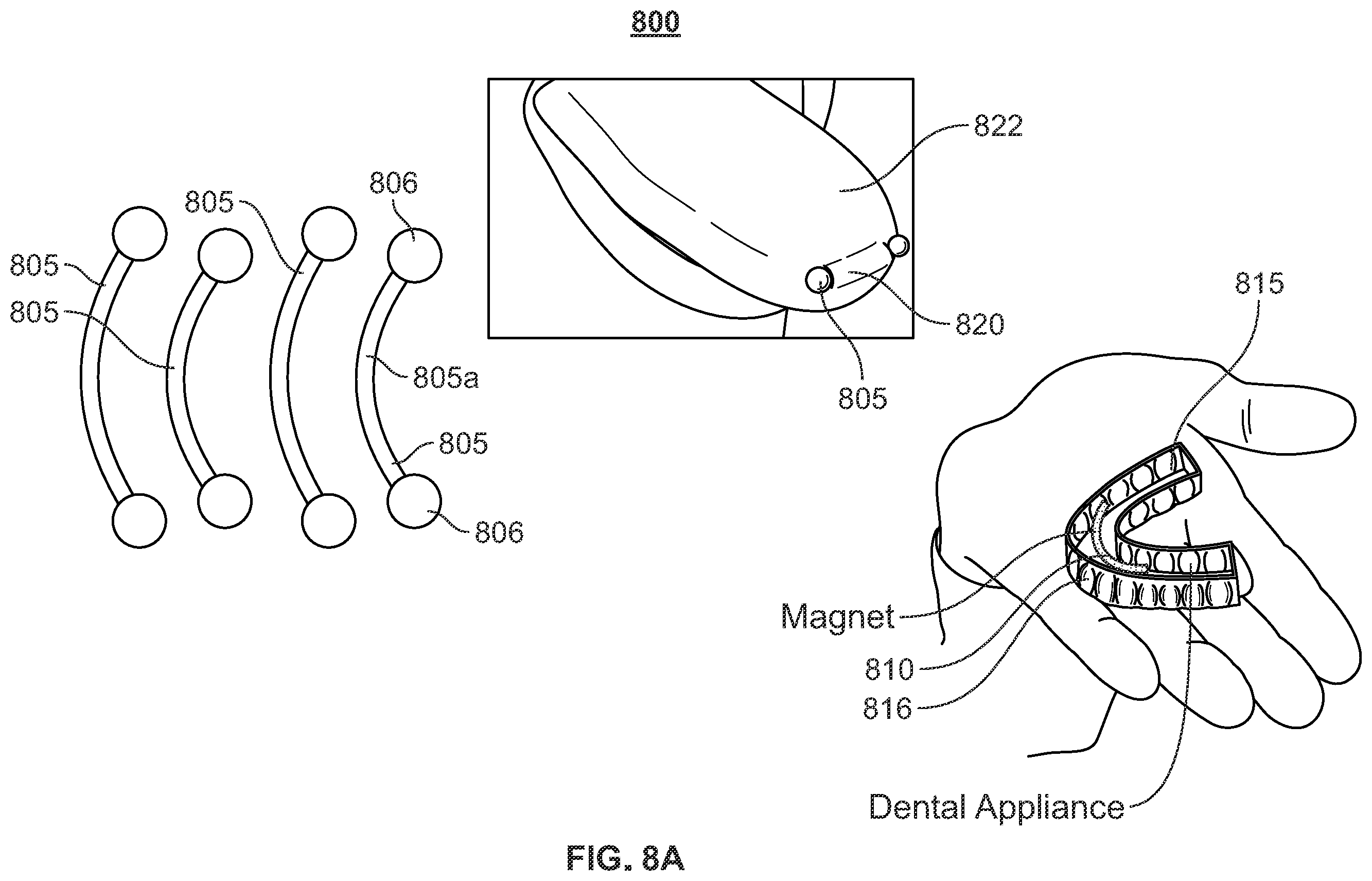 Patent US12496212 Figure 20 – Devices for treating obstructive sleep apnea