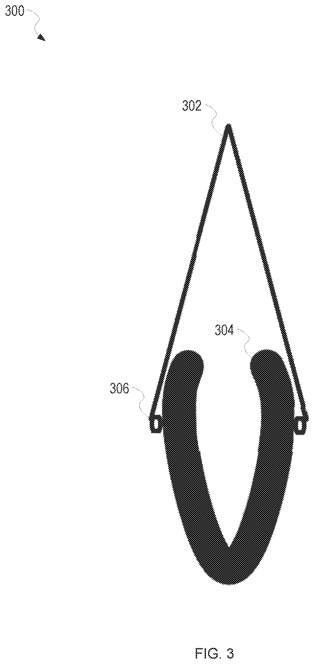 Patent US12496213 Figure 3 – Thermally activated pessary