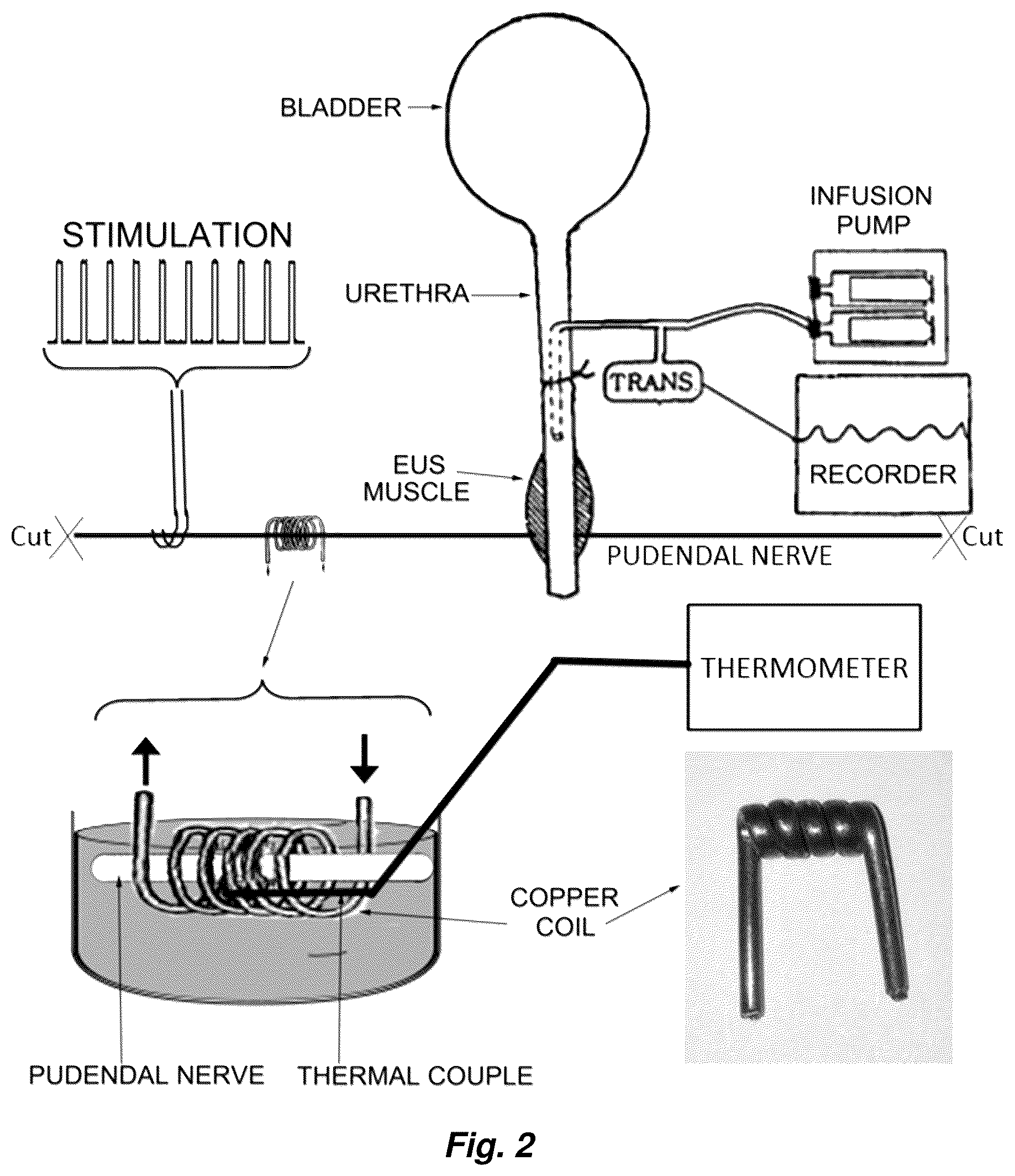 Patent US12496216 Figure 2 – Device and method for nerve block by local cooling to room temperature