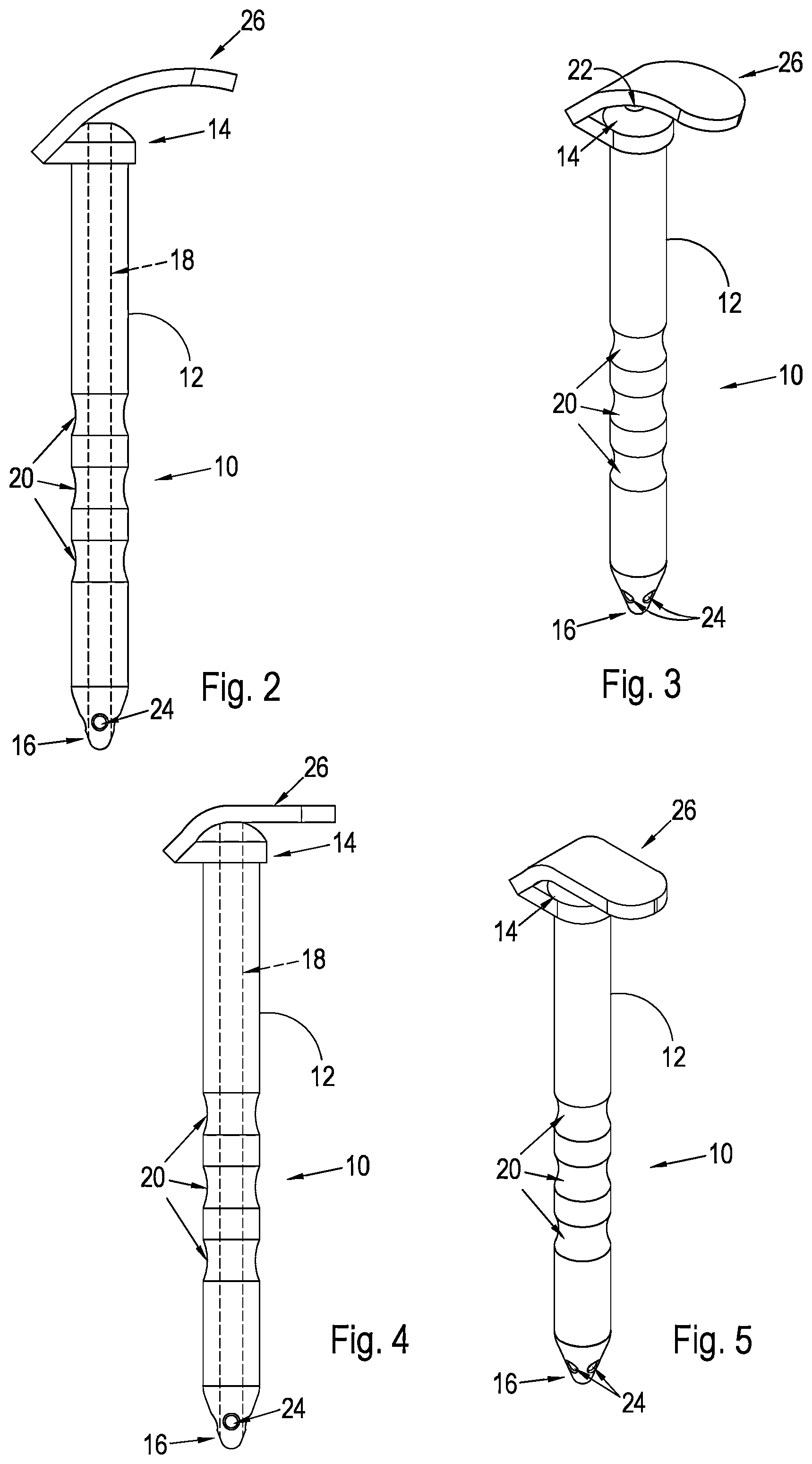 Patent US12496221 Figure 2 – Shunt and method for treating glaucoma