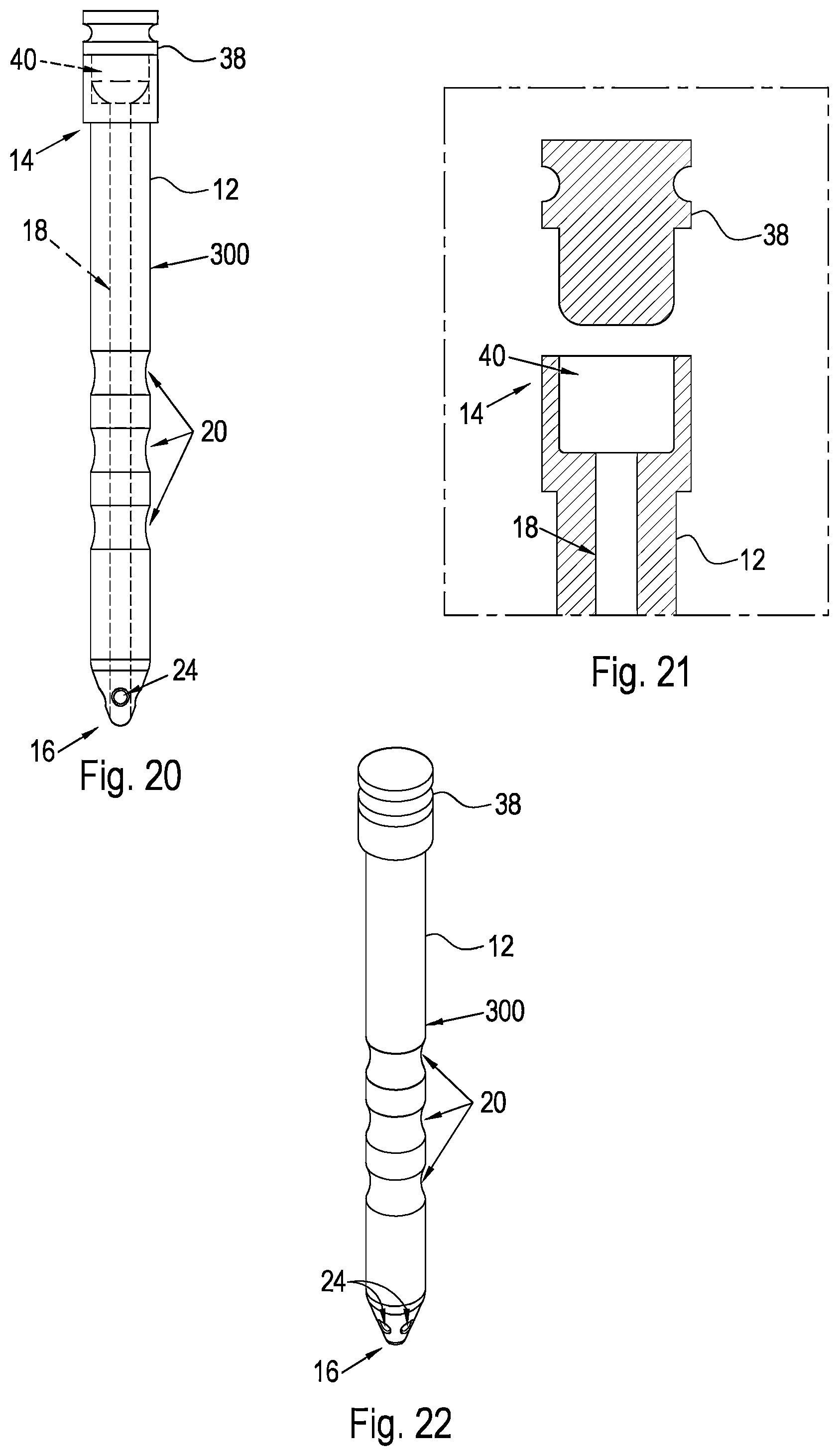 Patent US12496221 Figure 12 – Shunt and method for treating glaucoma