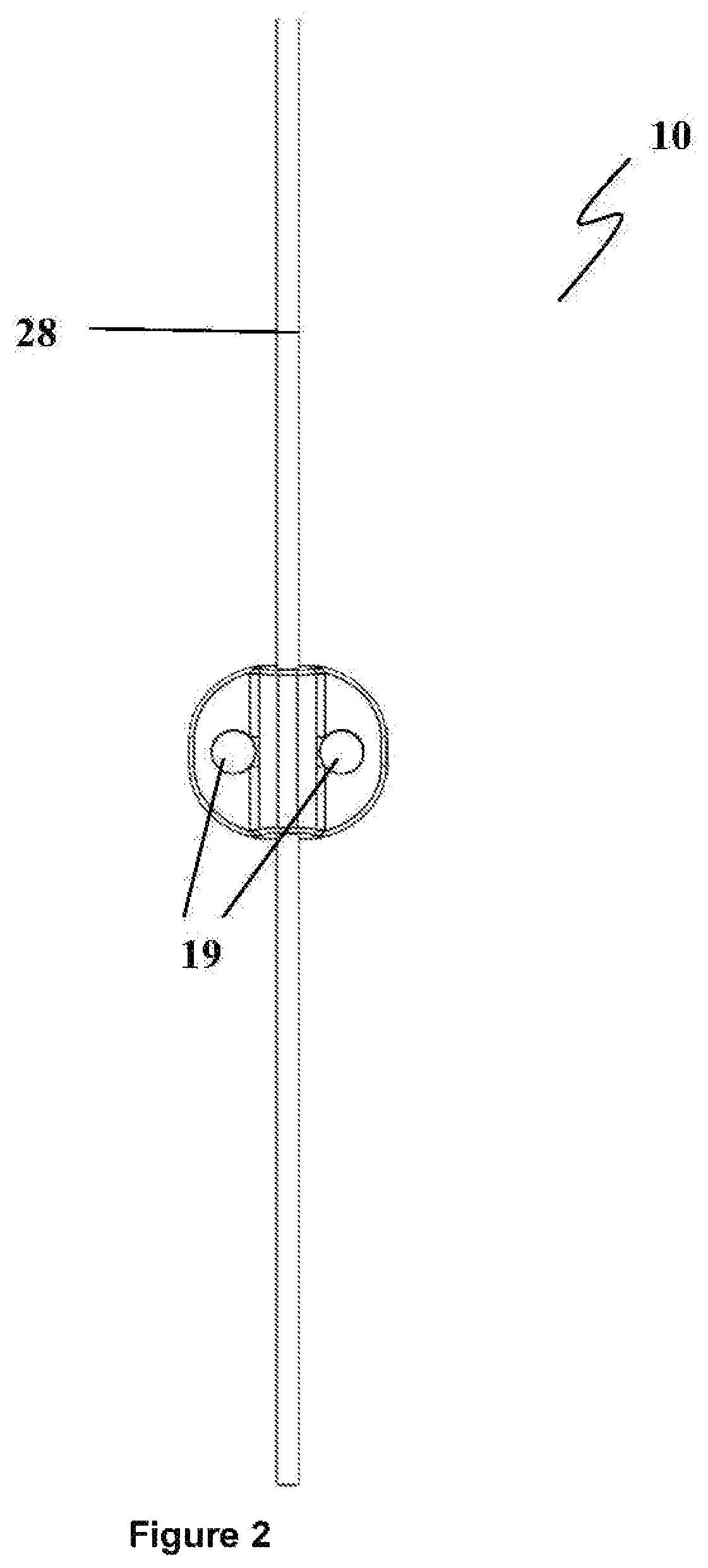 Patent US12496222 Figure 2 – Ocular drainage implant