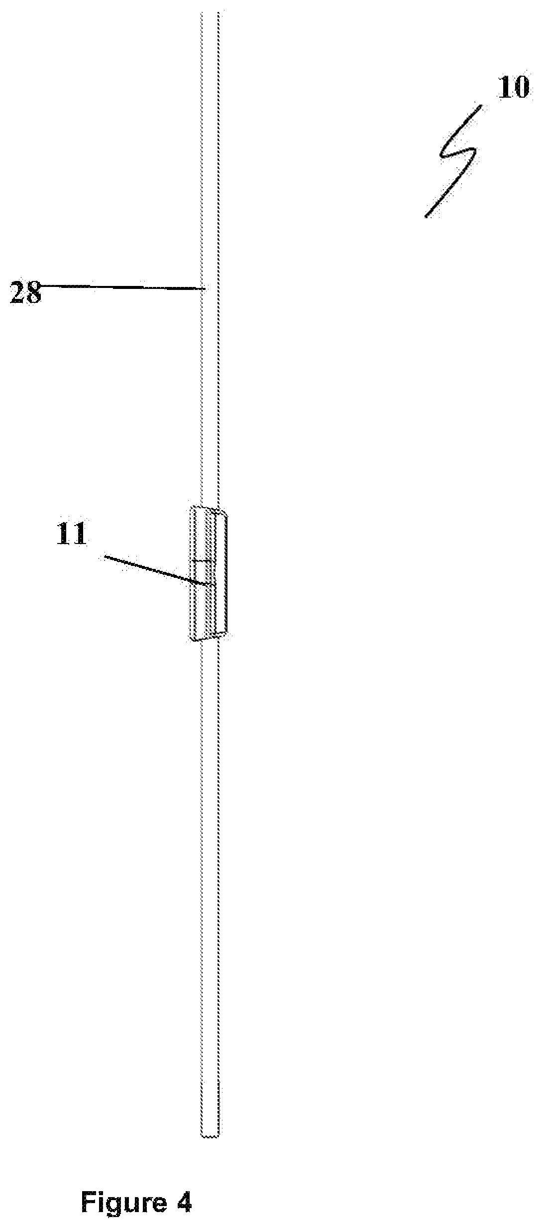 Patent US12496222 Figure 4 – Ocular drainage implant