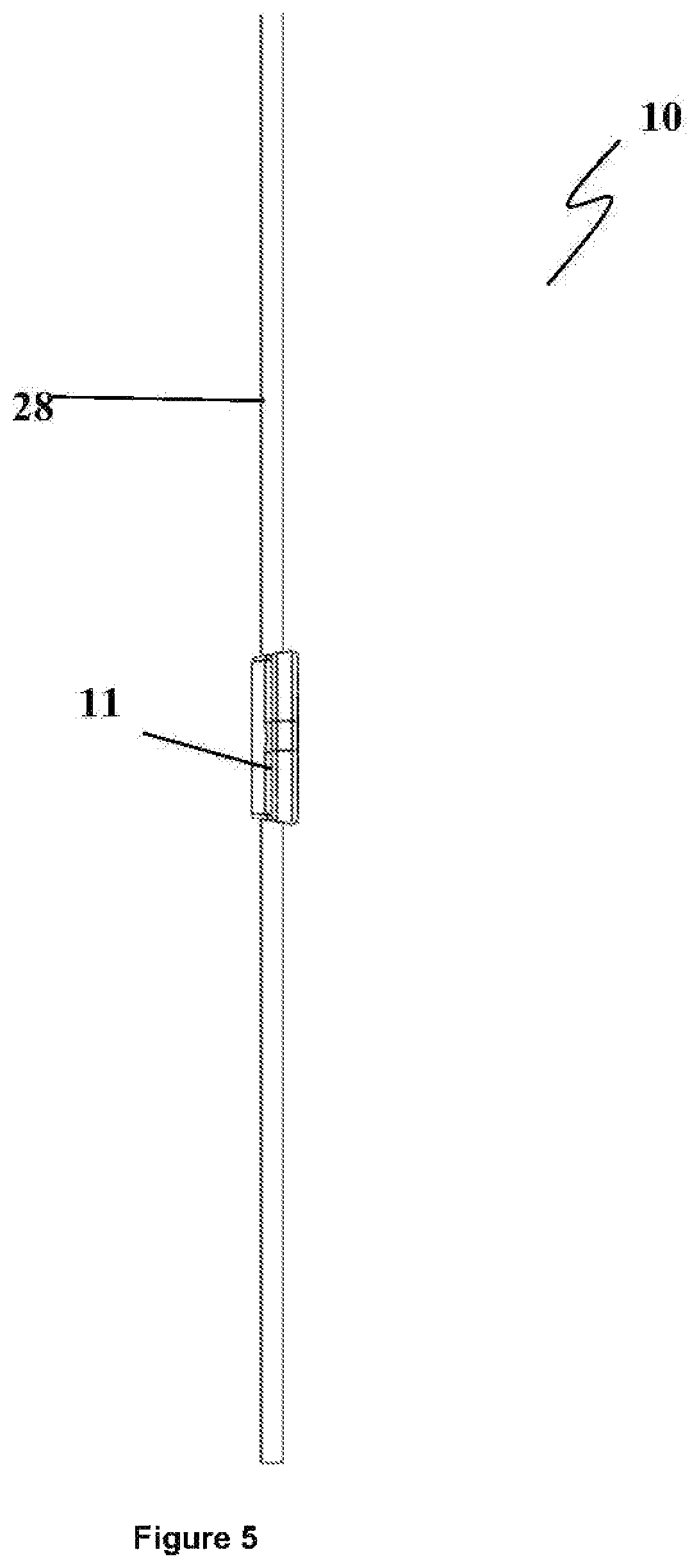 Patent US12496222 Figure 5 – Ocular drainage implant