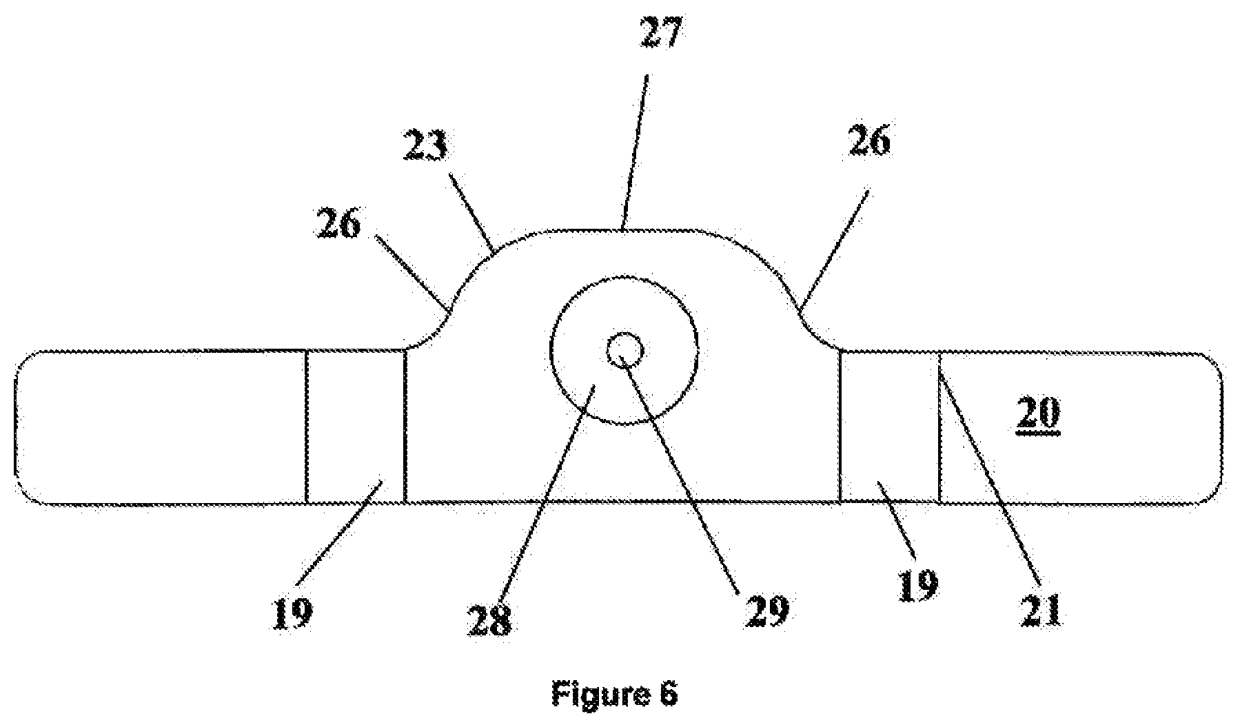 Patent US12496222 Figure 6 – Ocular drainage implant