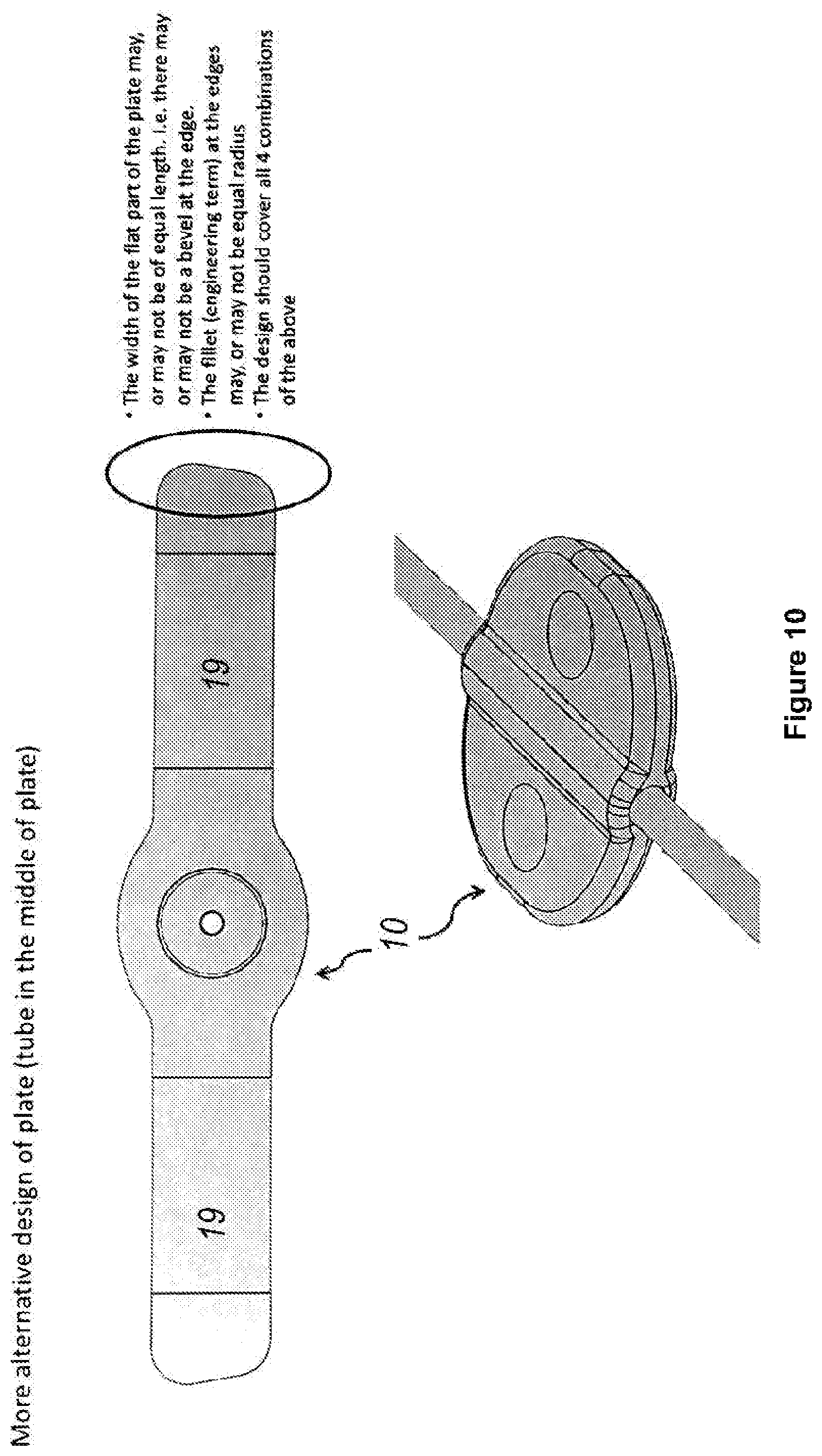 Patent US12496222 Figure 10 – Ocular drainage implant