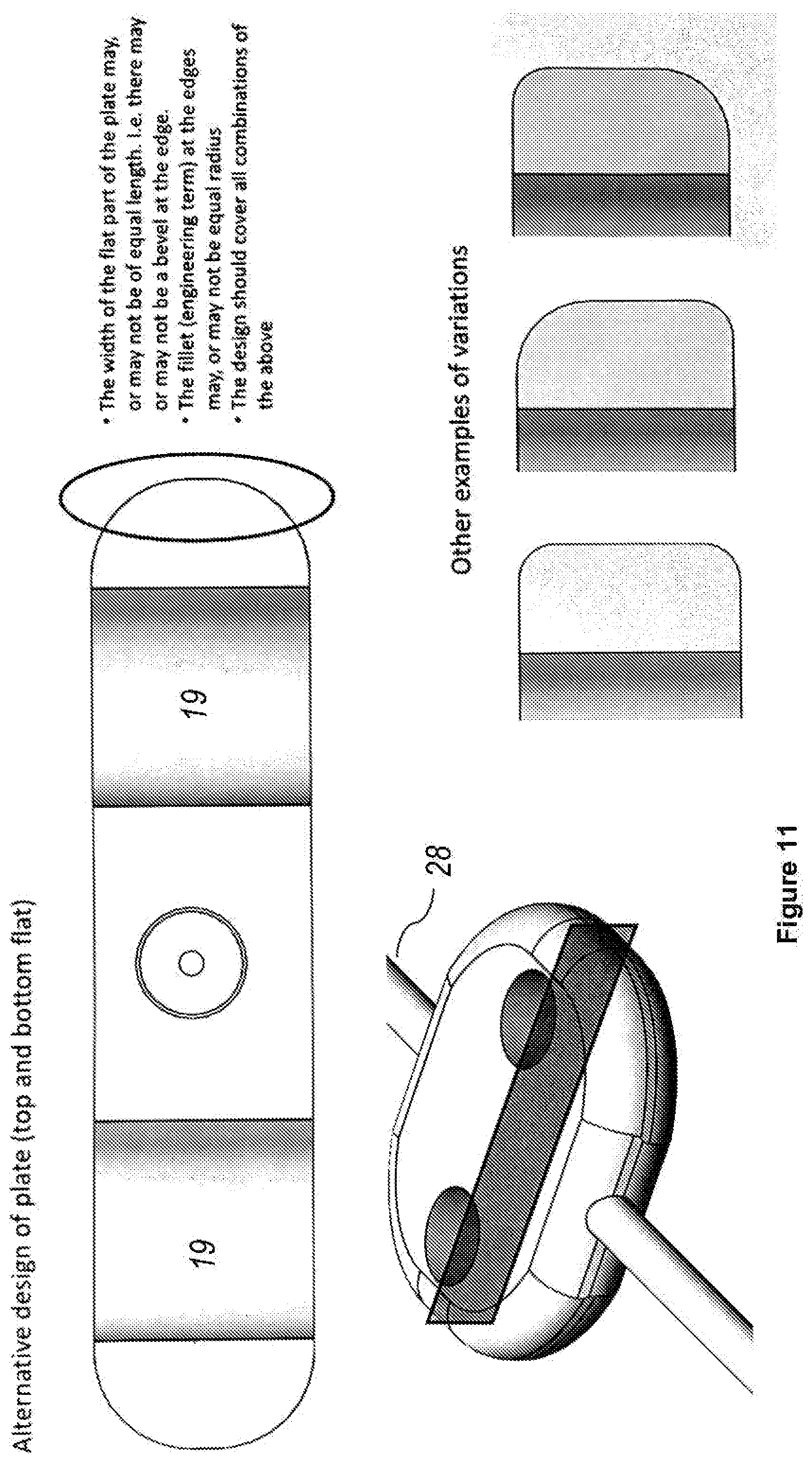 Patent US12496222 Figure 11 – Ocular drainage implant