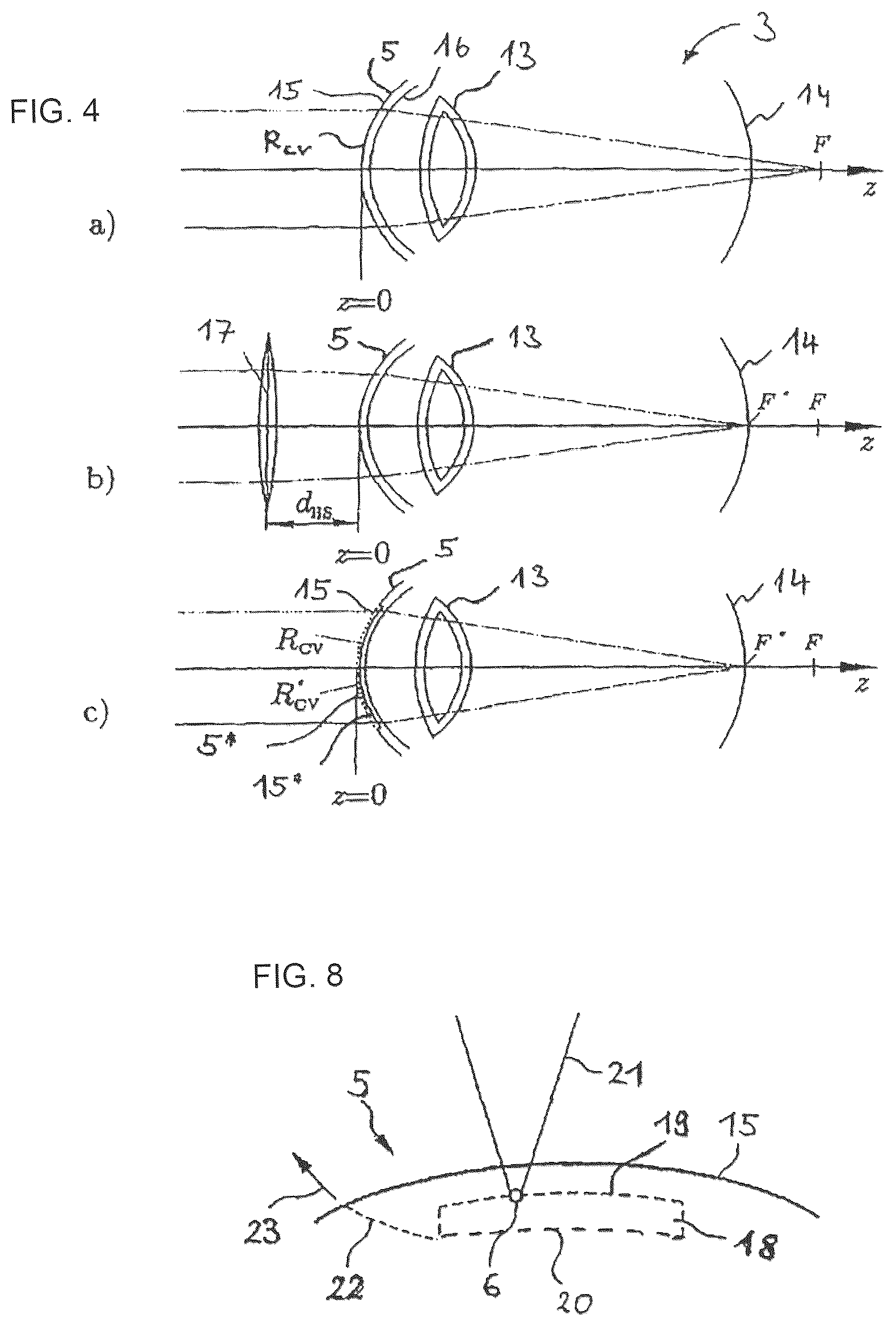 Patent US12496223 Figure 4 – Treatment apparatus for surgical correction of defective eyesight, method of generating control data therefore, and method for surgical correction of defective eyesight