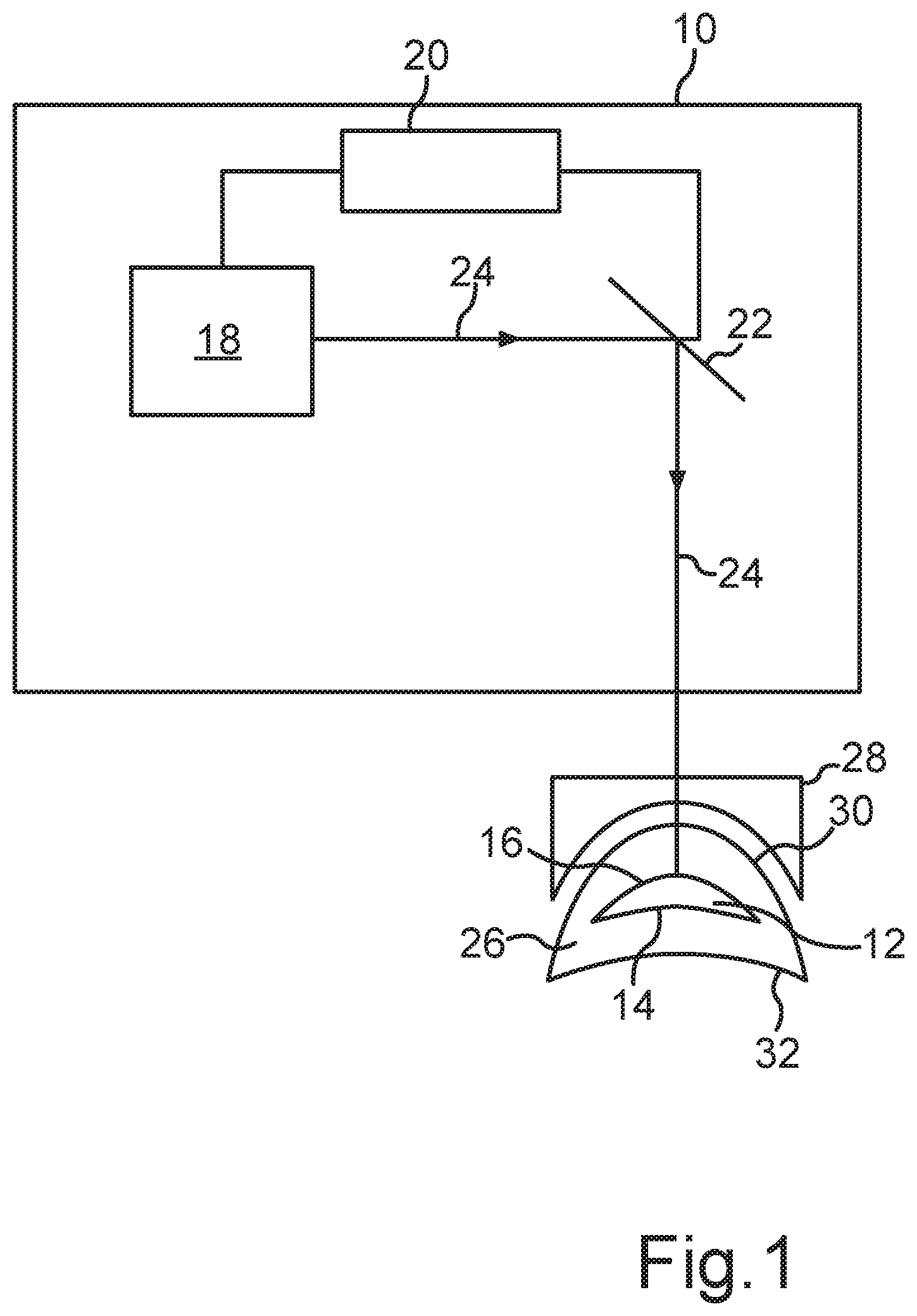 Patent US12496224 Figure 1 – Method for providing control data for a laser of a treatment apparatus