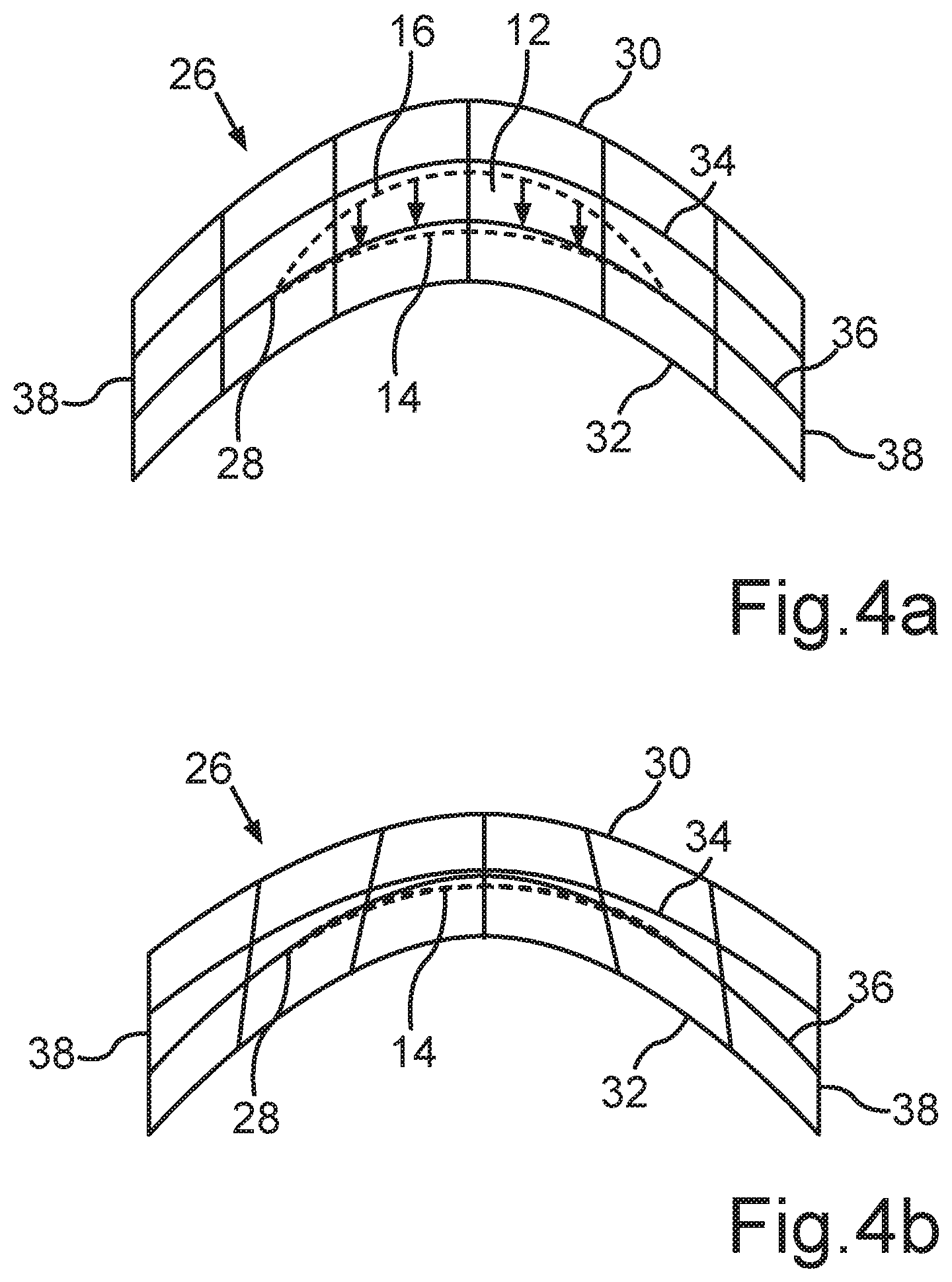 Patent US12496224 Figure 4 – Method for providing control data for a laser of a treatment apparatus