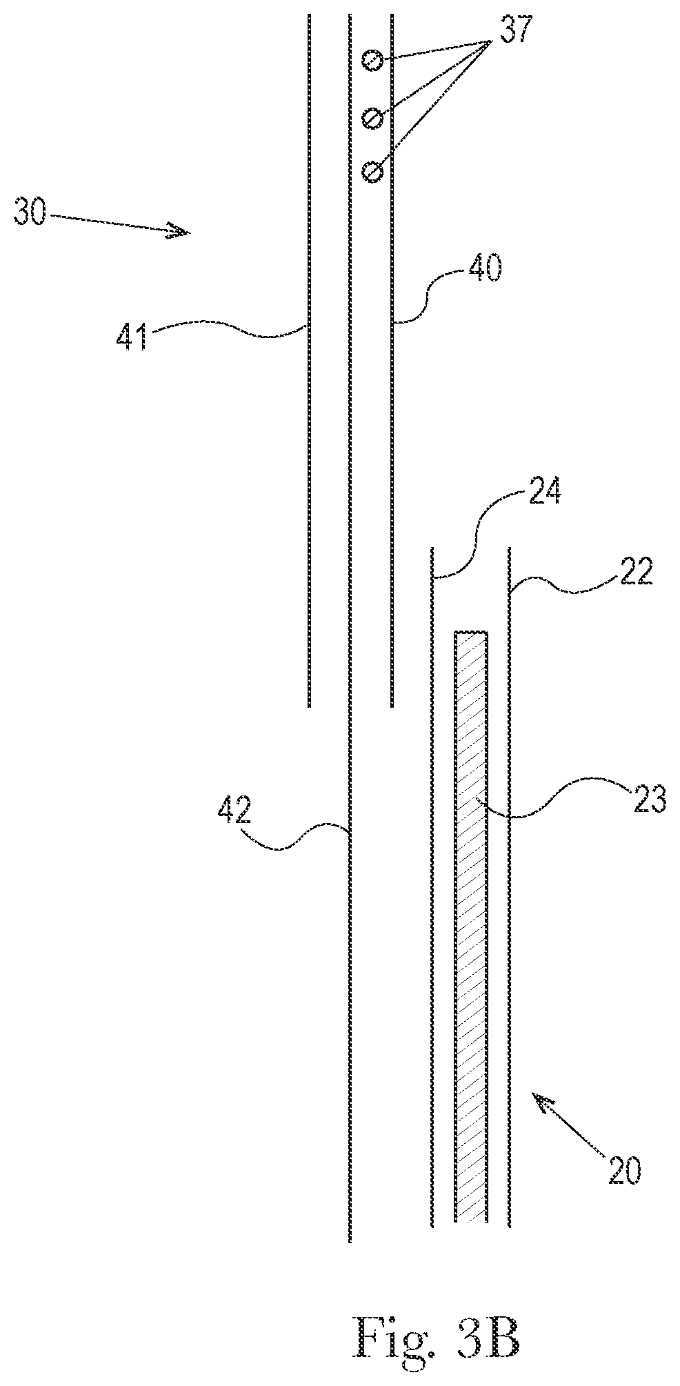 Patent US12496235 Figure 4 – Disposable absorbent pants with advantageous stretch and manufacturability features, and methods for manufacturing the same