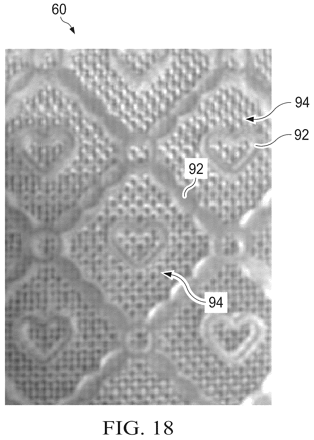 Patent US12496238 Figure 11 – Shaped nonwoven