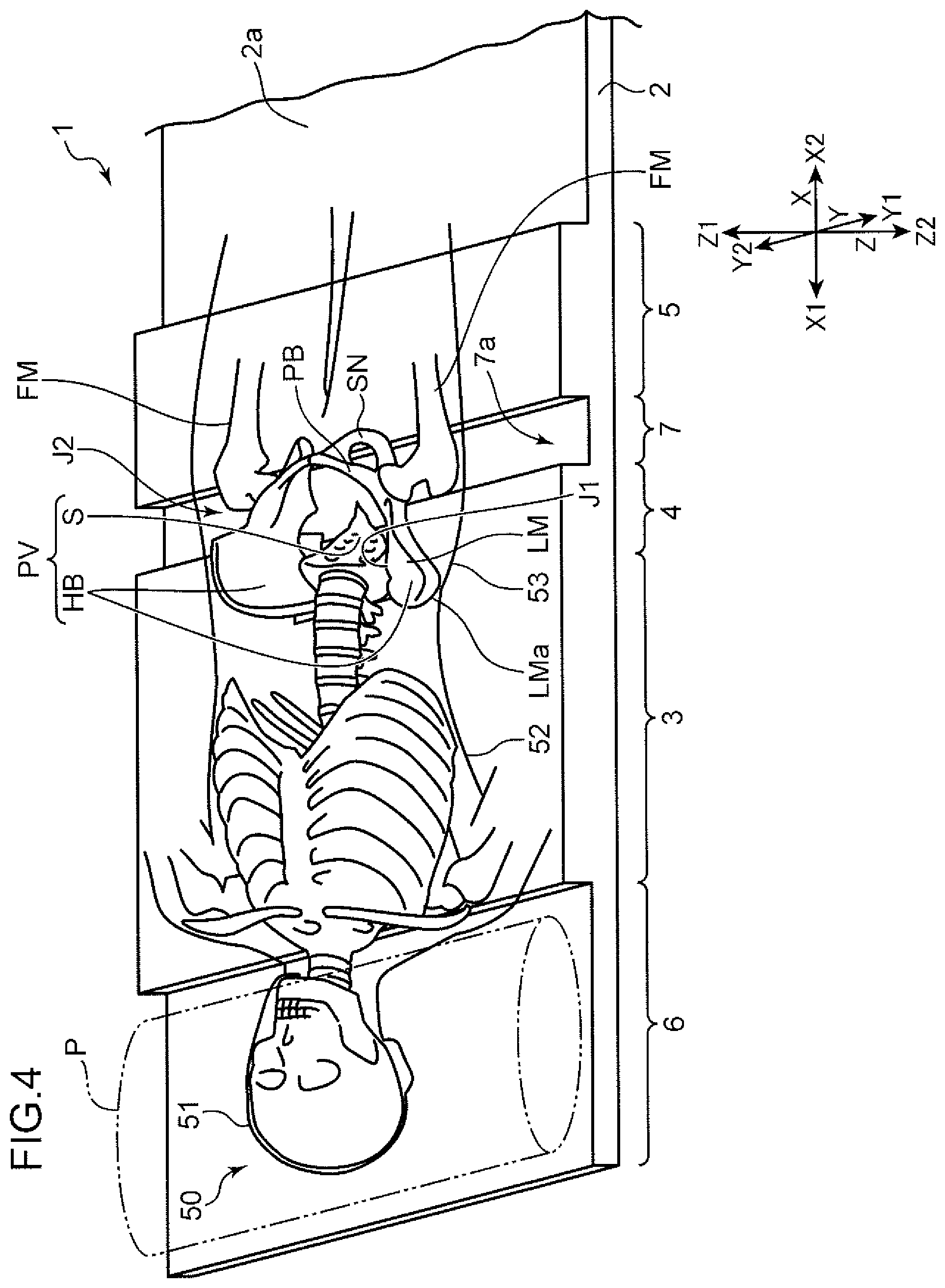 Patent US12496242 Figure 4 – Mat
