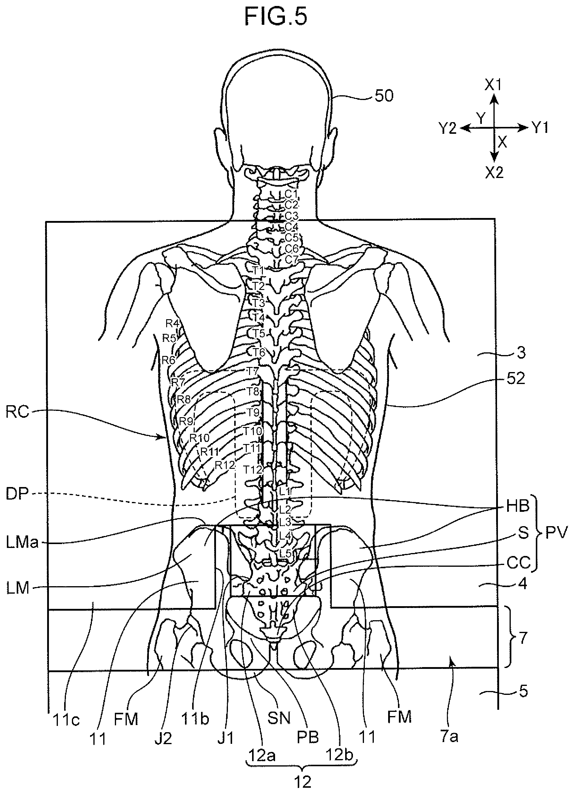 Patent US12496242 Figure 5 – Mat