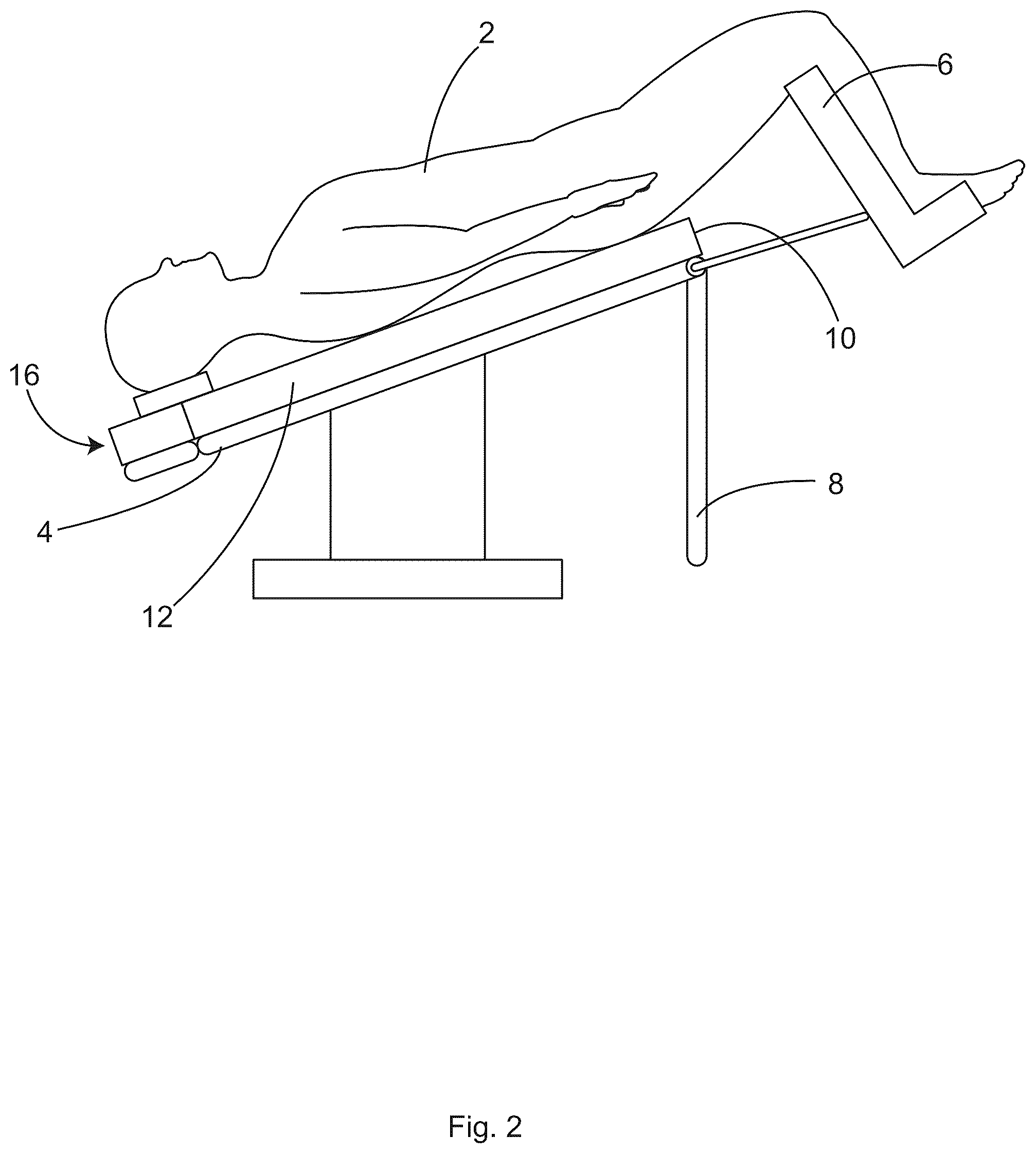 Patent US12496245 Figure 2 – Patient securement system for the surgical trendelenburg position