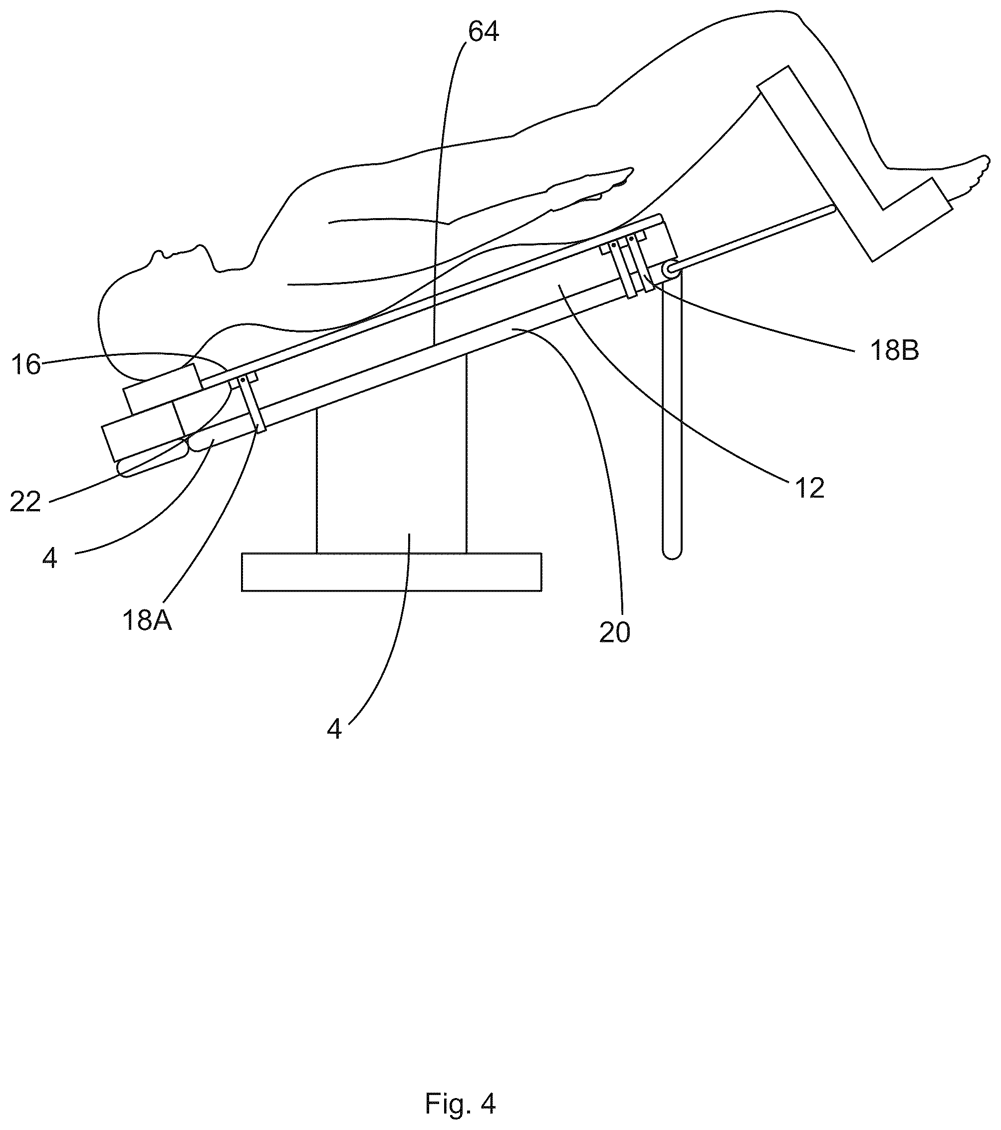 Patent US12496245 Figure 4 – Patient securement system for the surgical trendelenburg position