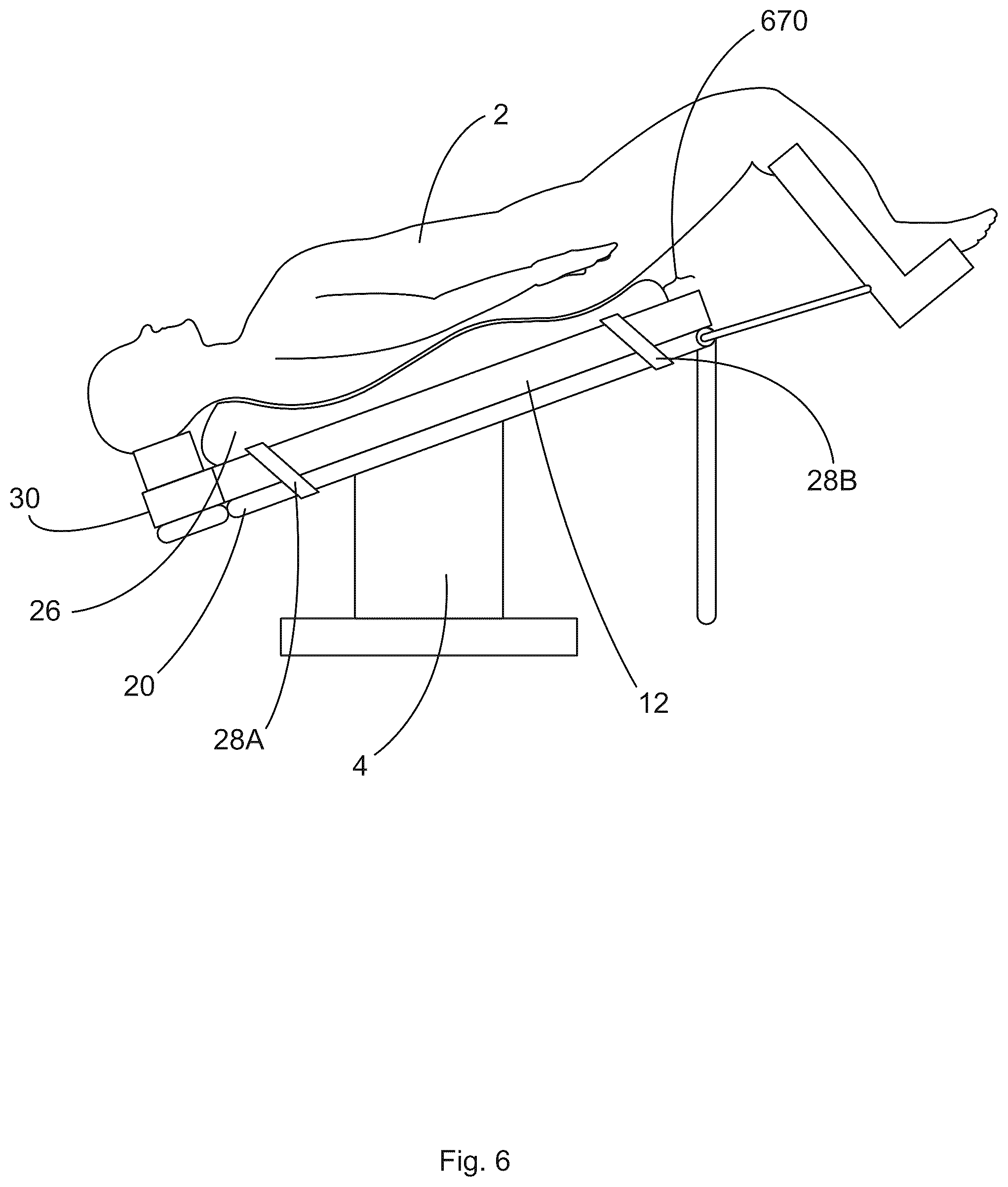 Patent US12496245 Figure 6 – Patient securement system for the surgical trendelenburg position