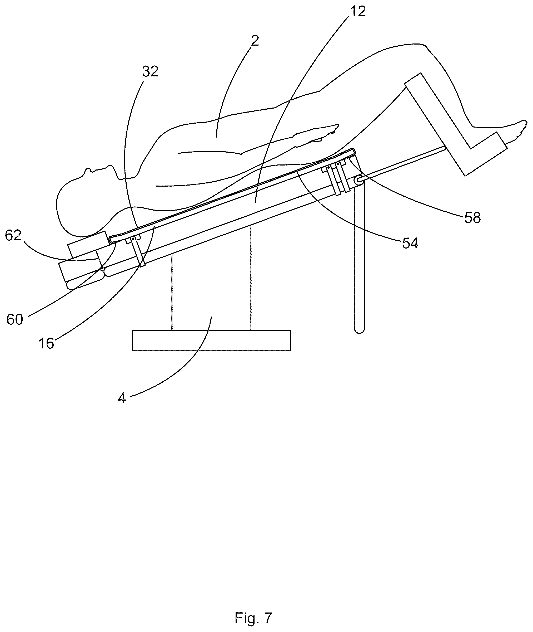 Patent US12496245 Figure 7 – Patient securement system for the surgical trendelenburg position