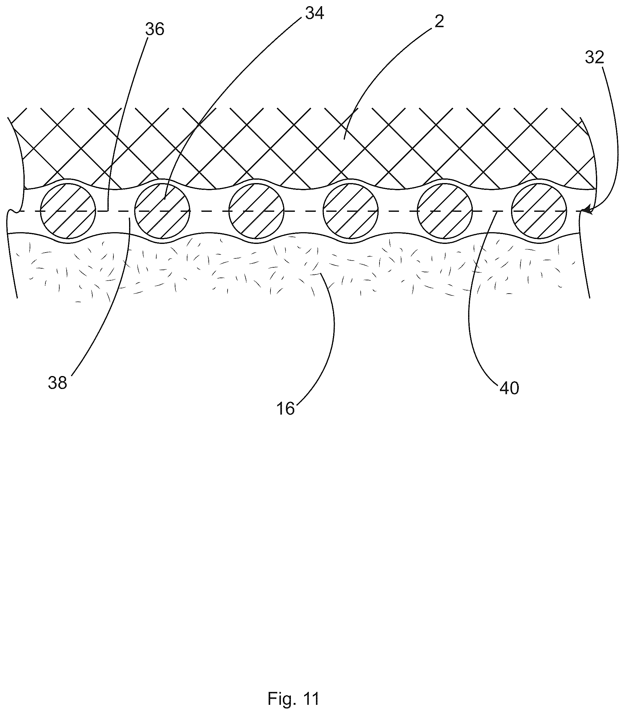 Patent US12496245 Figure 11 – Patient securement system for the surgical trendelenburg position