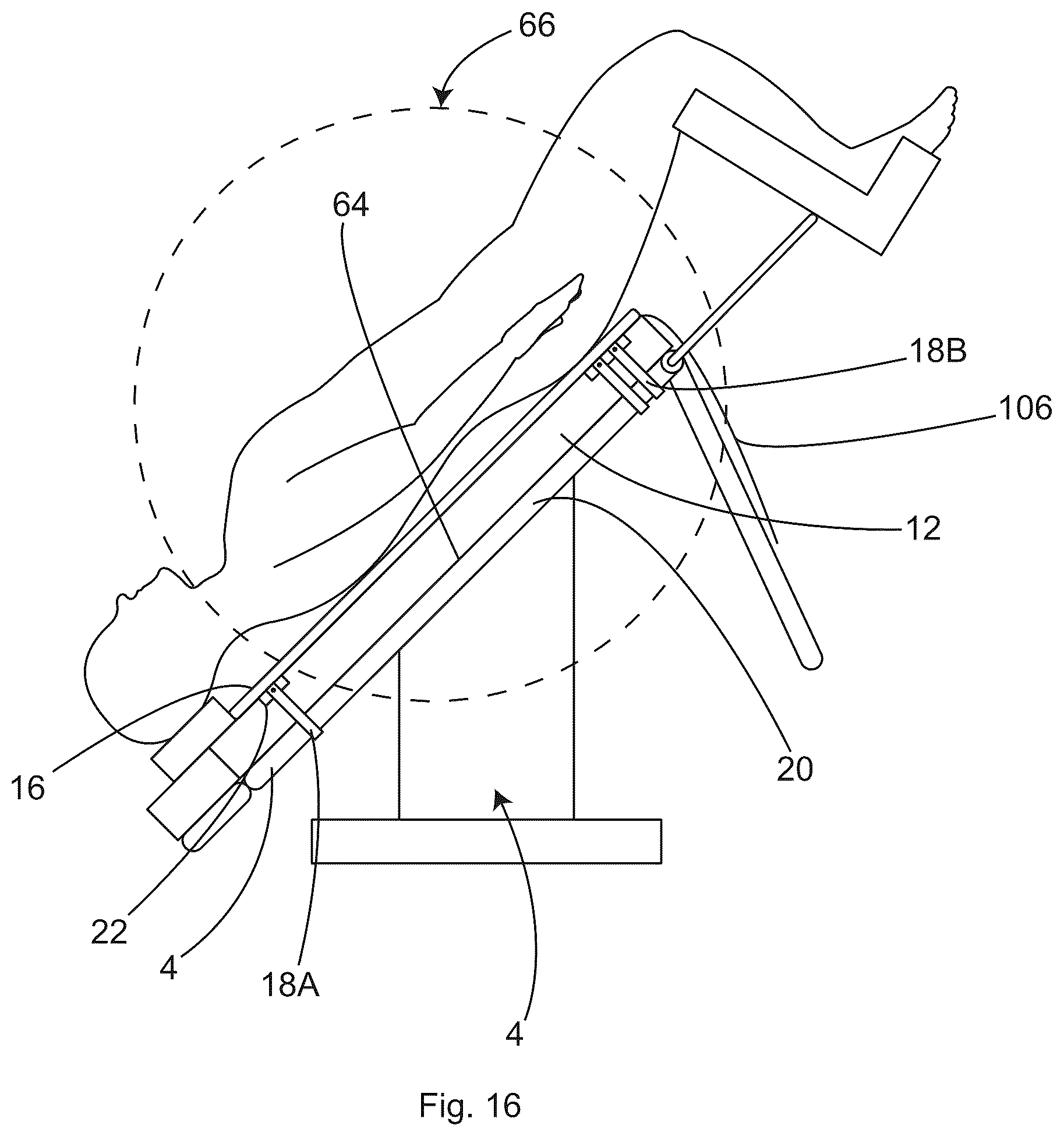 Patent US12496245 Figure 15 – Patient securement system for the surgical trendelenburg position