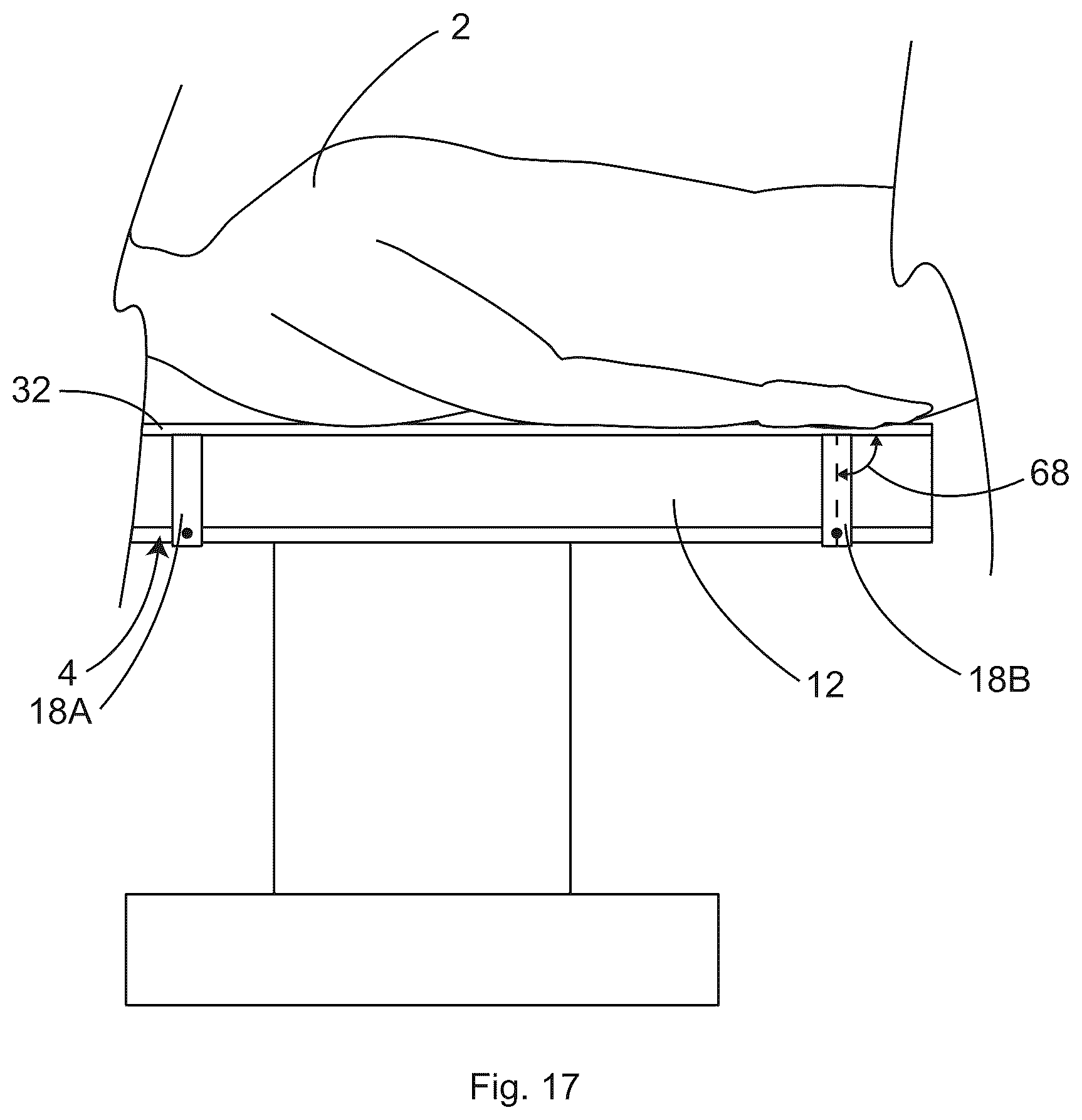 Patent US12496245 Figure 16 – Patient securement system for the surgical trendelenburg position
