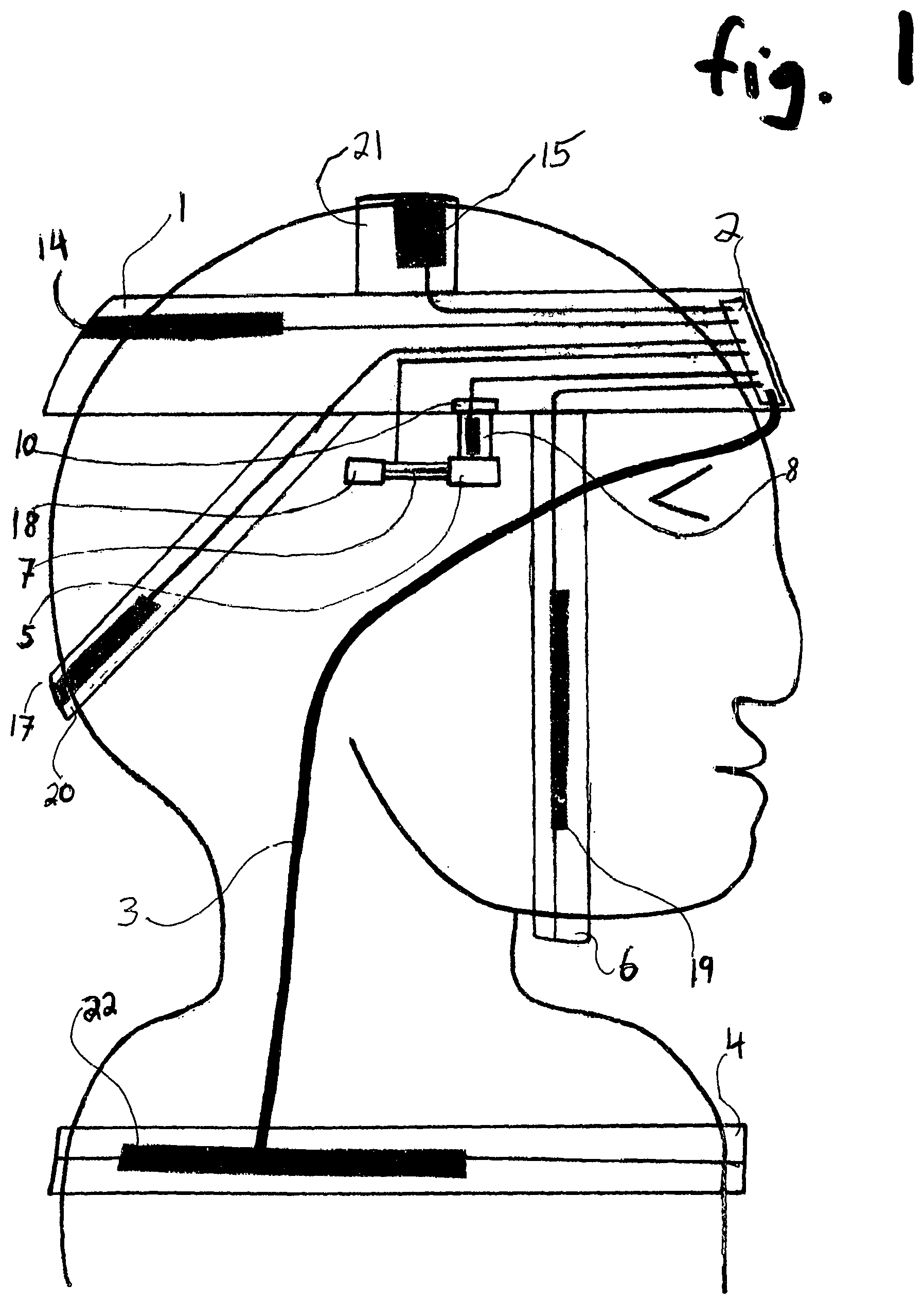 Patent US12496248 Figure 1 – Headband that contracts in synchrony with inspiration during sleep
