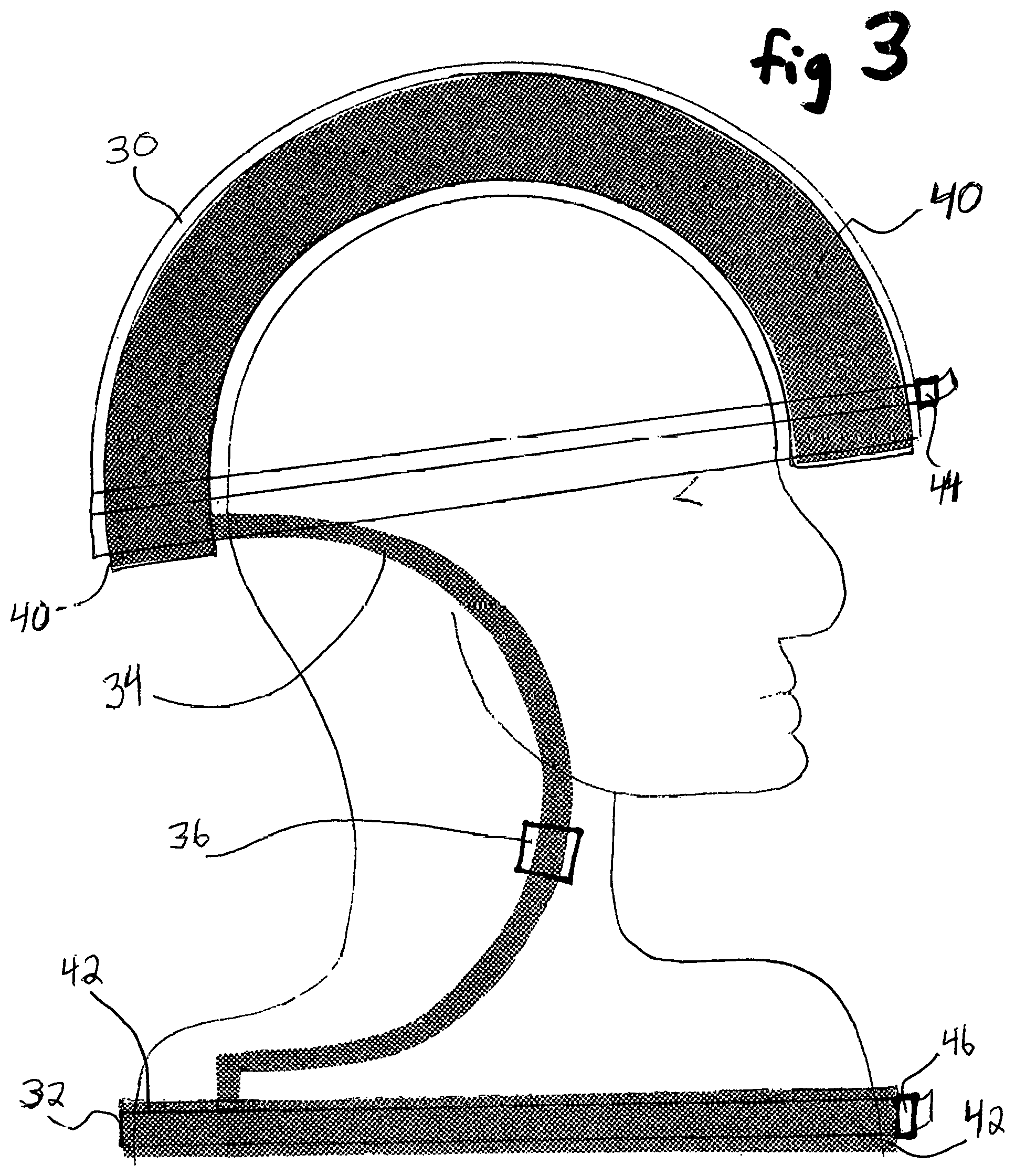 Patent US12496248 Figure 3 – Headband that contracts in synchrony with inspiration during sleep
