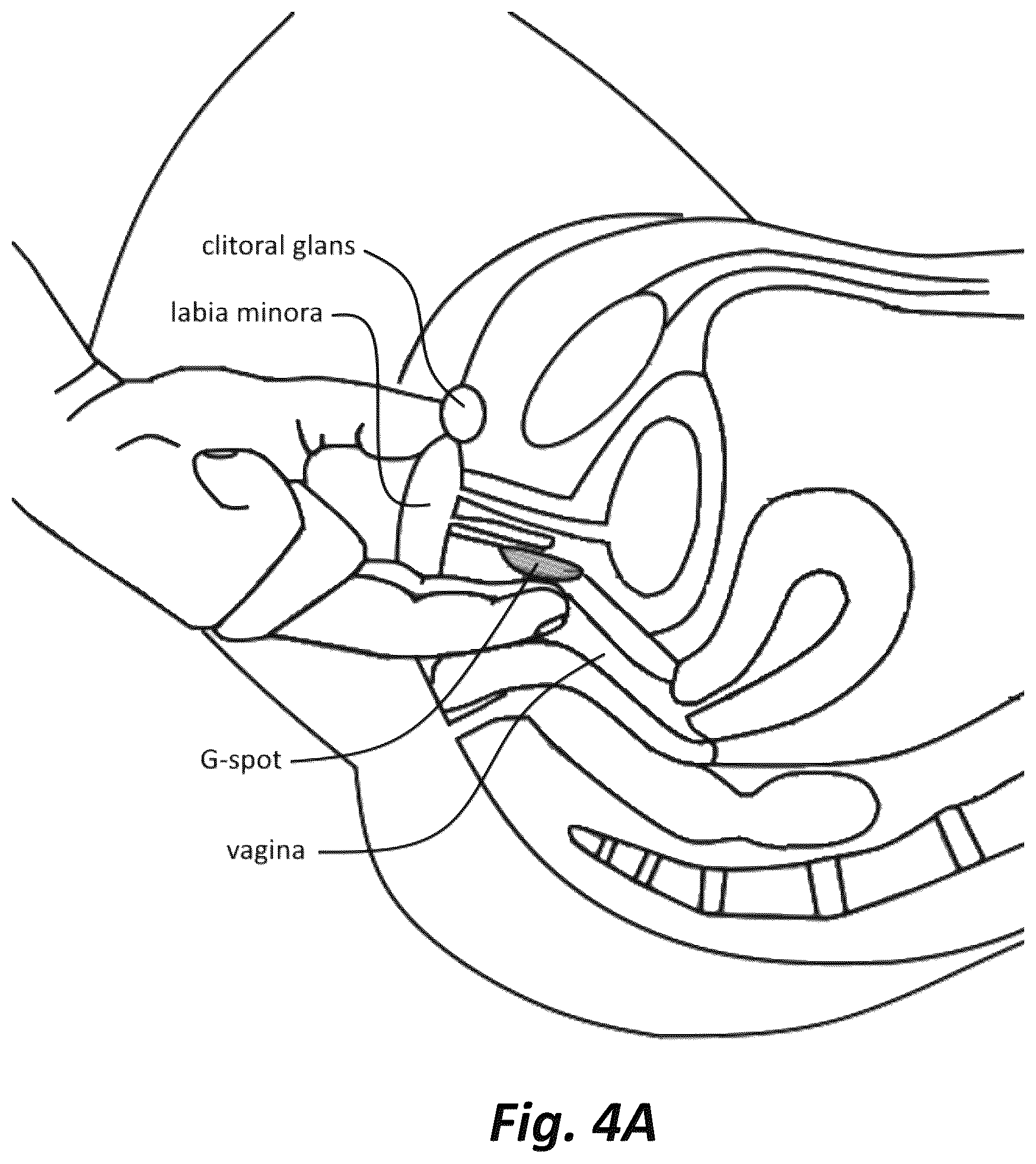 Patent US12496250 Figure 4 – System, apparatus, and method for sexual stimulation