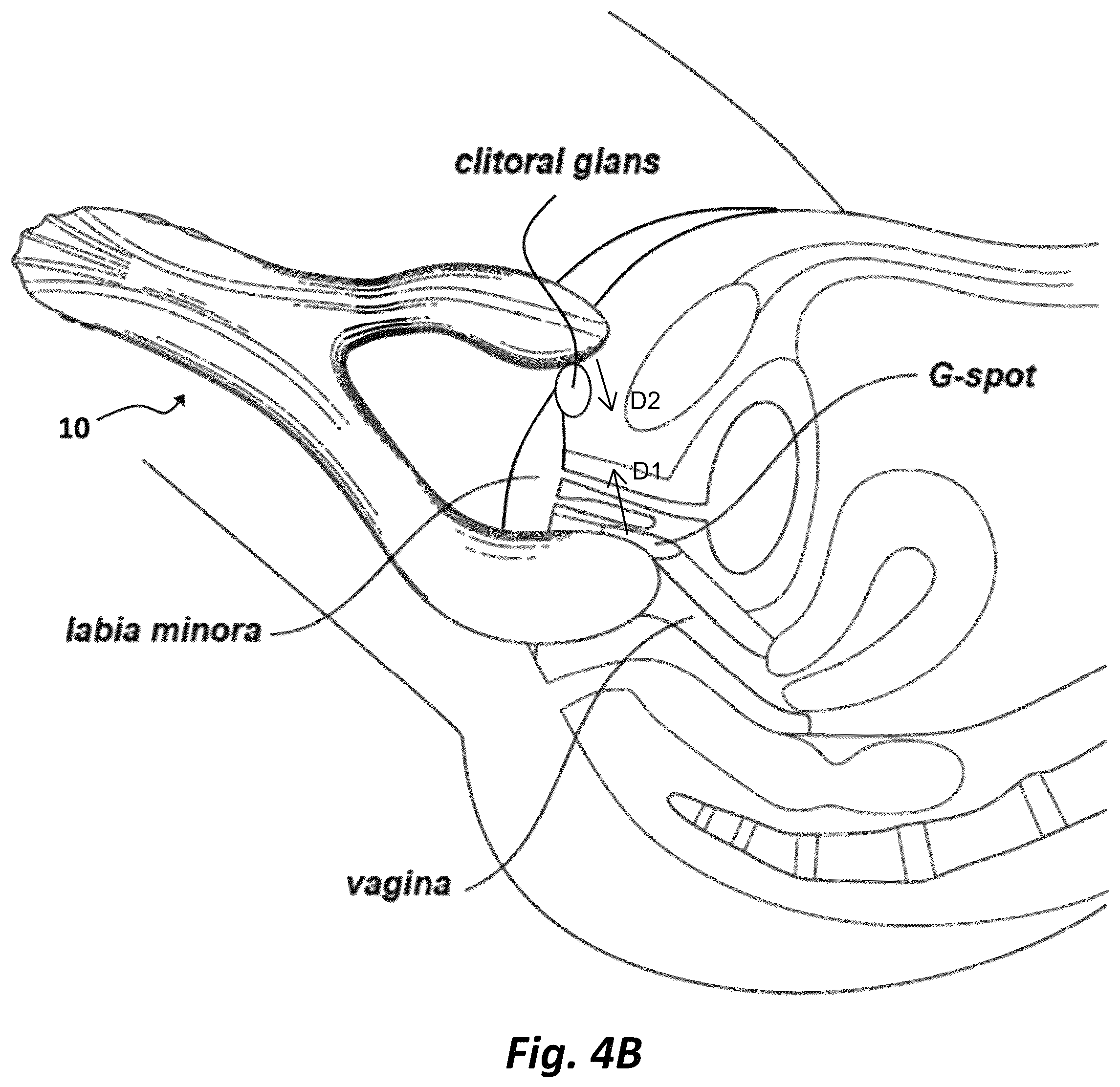 Patent US12496250 Figure 5 – System, apparatus, and method for sexual stimulation