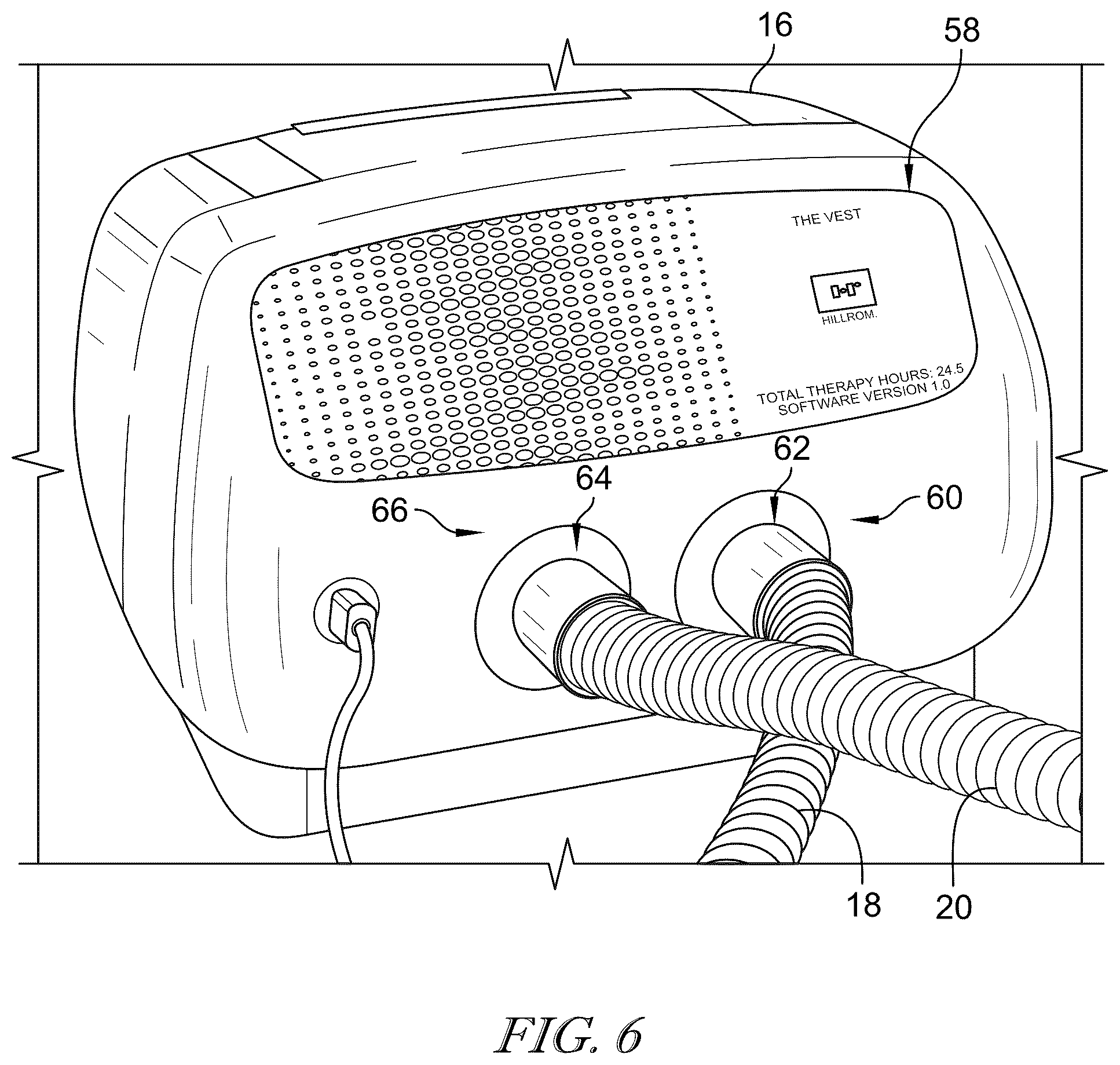 Patent US12496252 Figure 4 – Adaptive high frequency chest wall oscillation system
