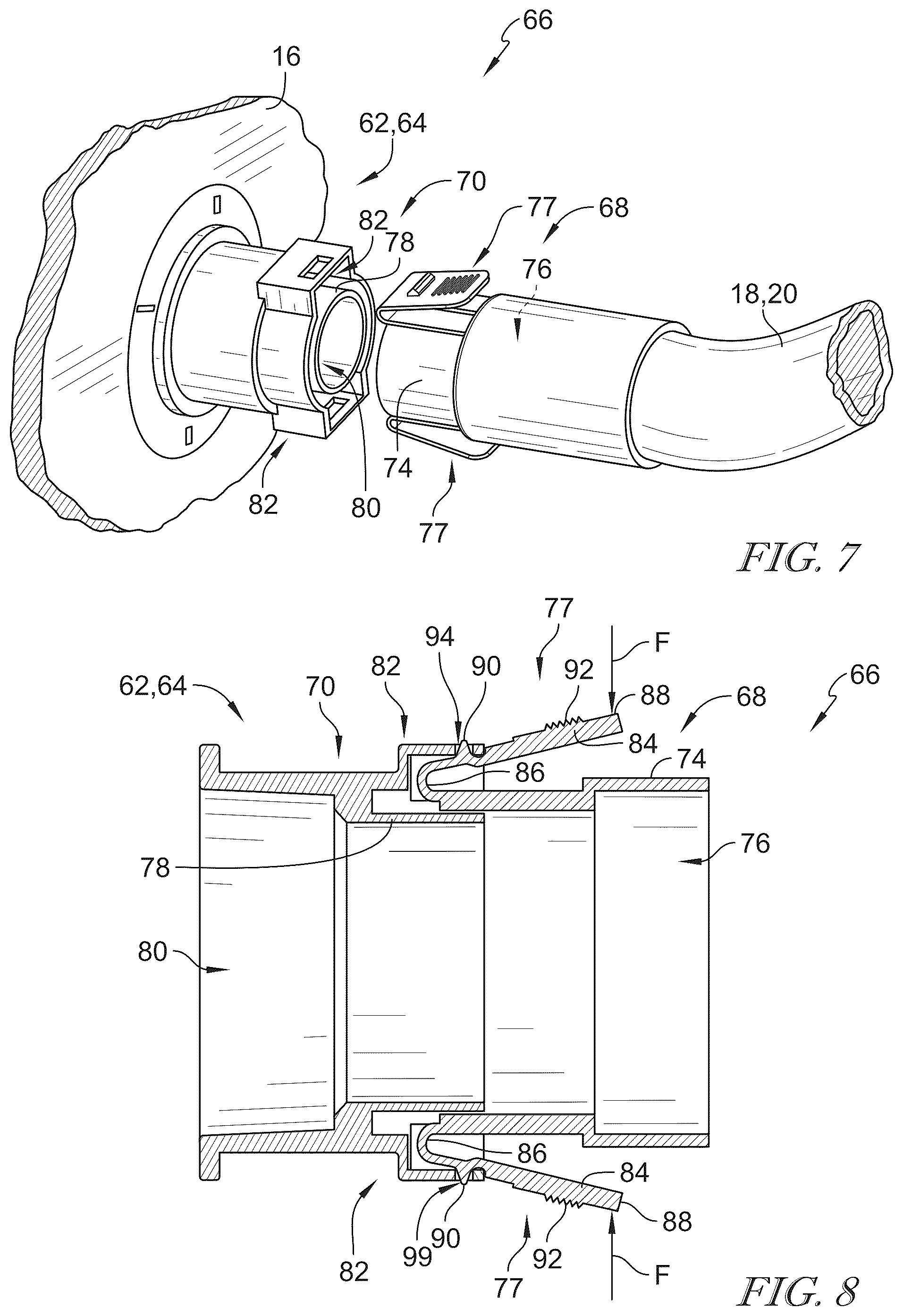 Patent US12496252 Figure 5 – Adaptive high frequency chest wall oscillation system