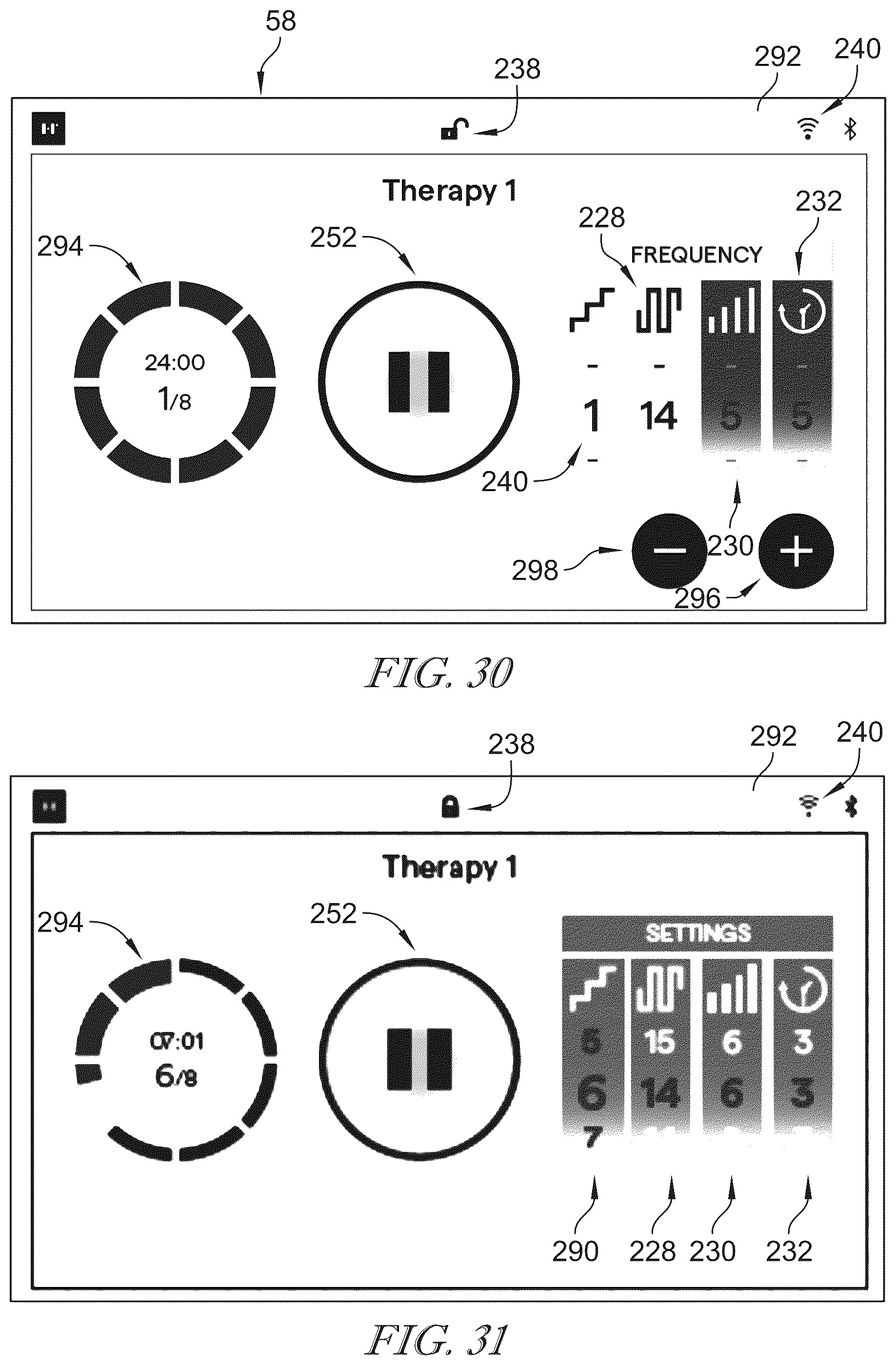 Patent US12496252 Figure 17 – Adaptive high frequency chest wall oscillation system