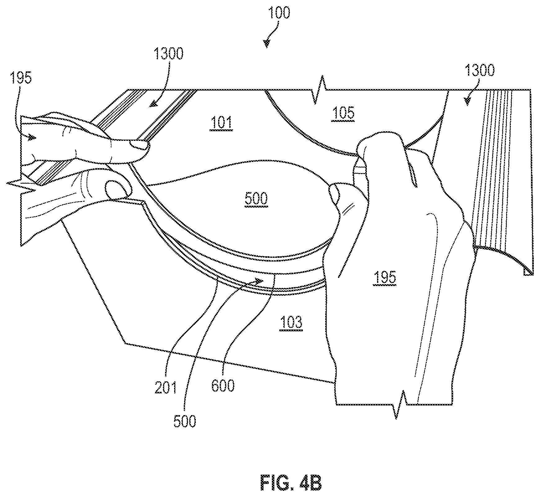 Patent US12496253 Figure 17 – Methods, systems, and/or devices for thermal treatments