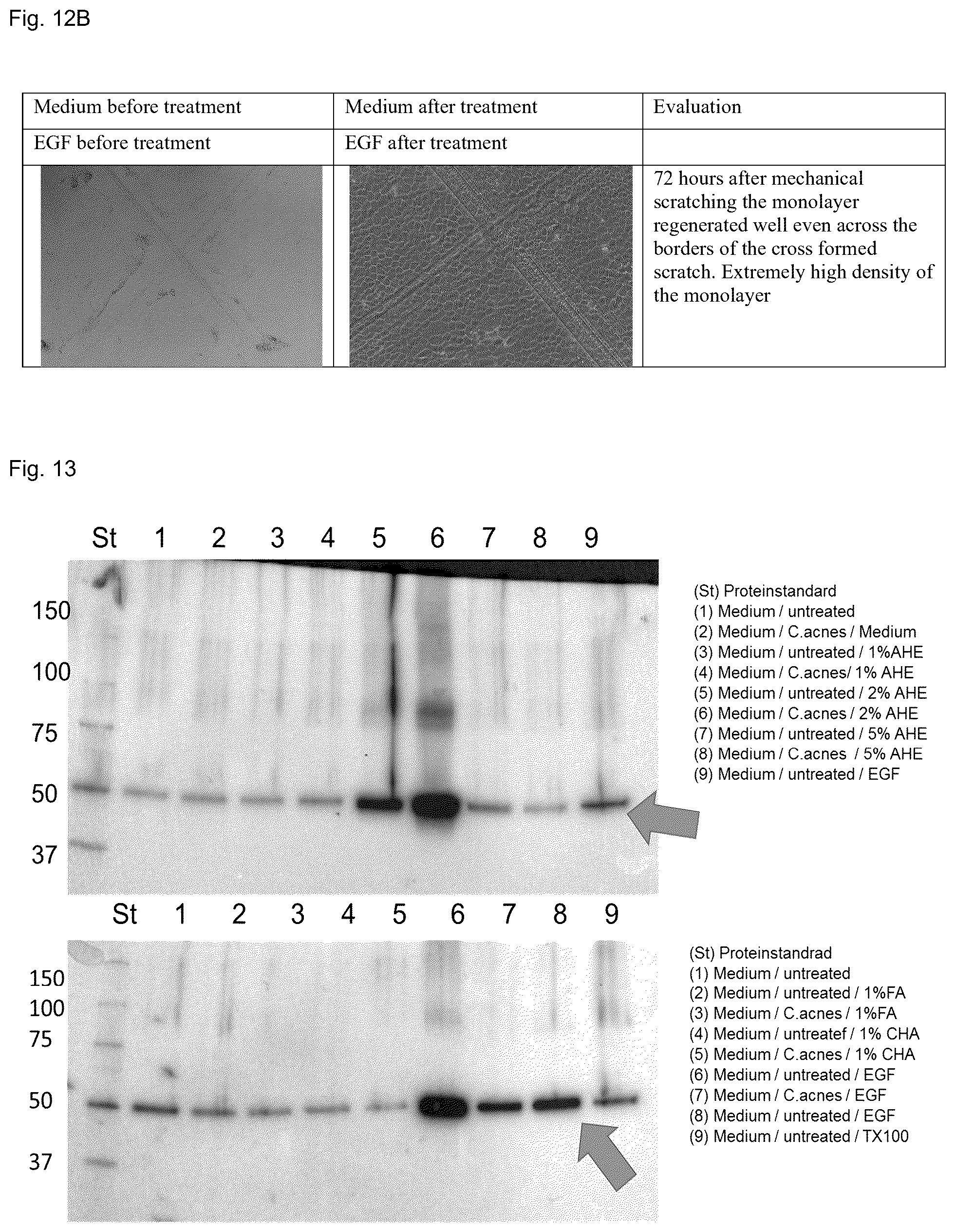 Patent US12496267 Figure 14 – Extract of organic humified materials