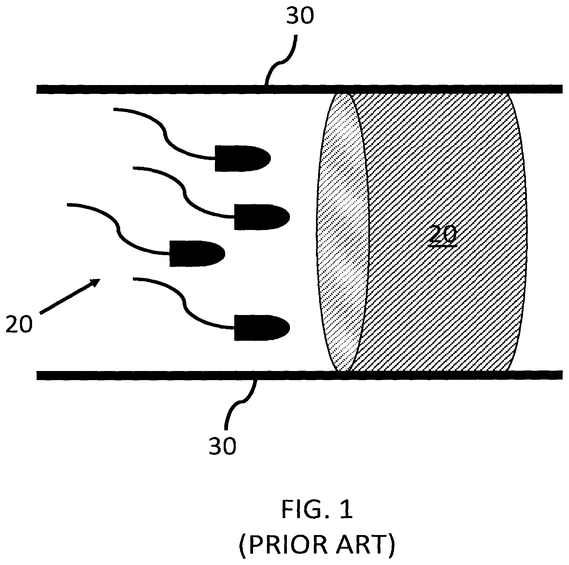 Patent US12496270 Figure 1 – Methods for reversible male birth control
