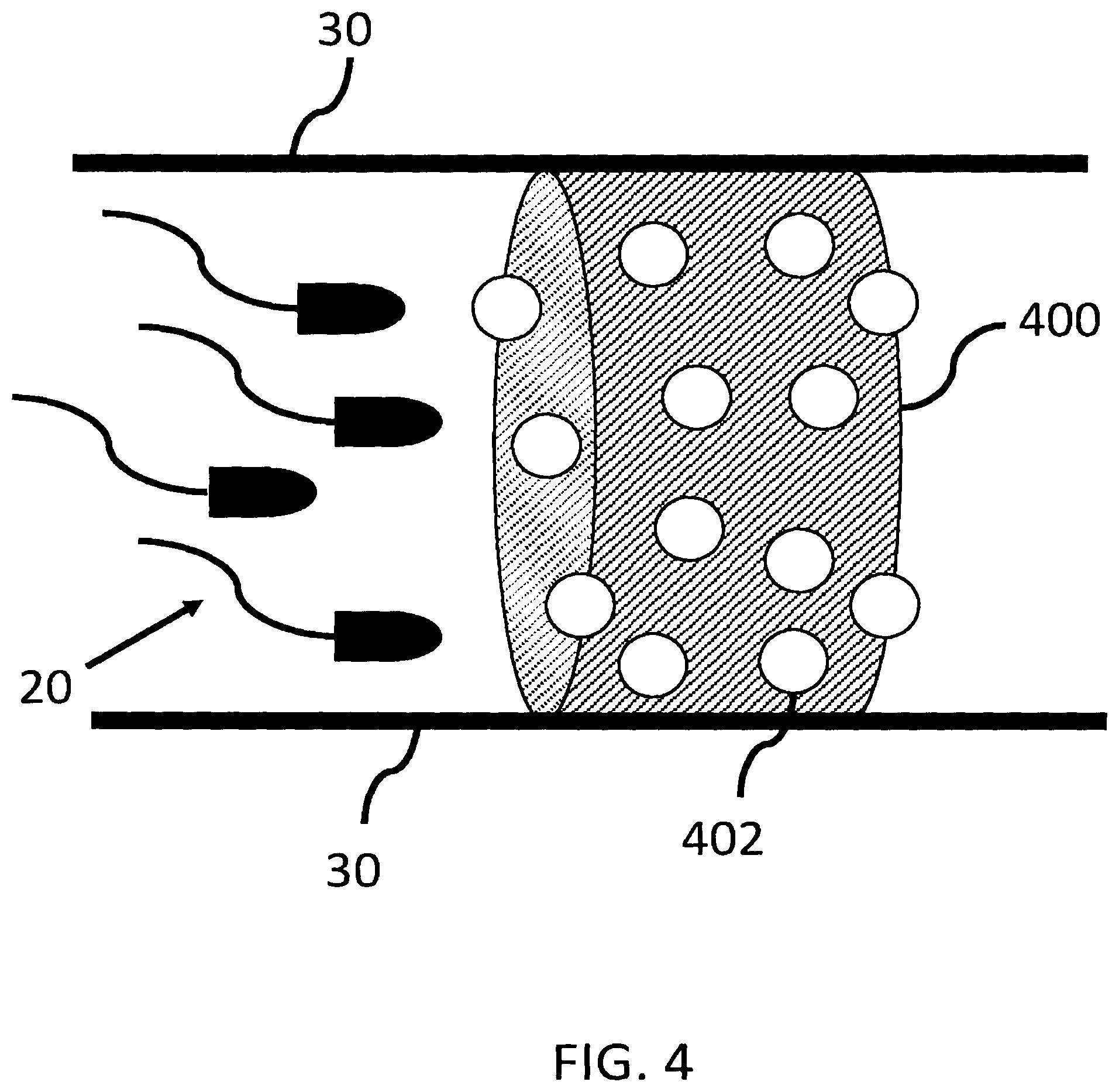 Patent US12496270 Figure 4 – Methods for reversible male birth control